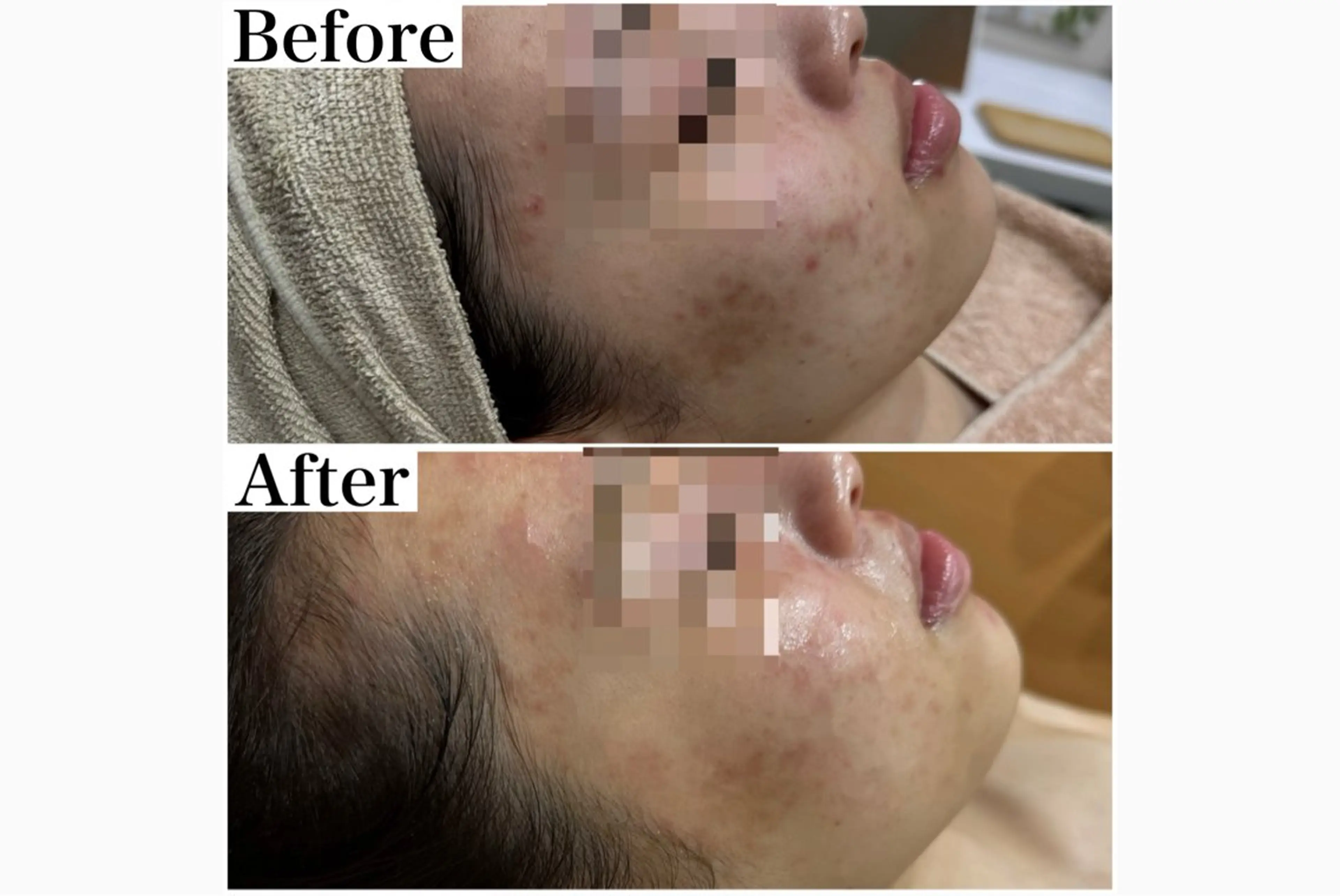 脱毛&フェイシャル 専門店muro.のエステ・リラクイメージ