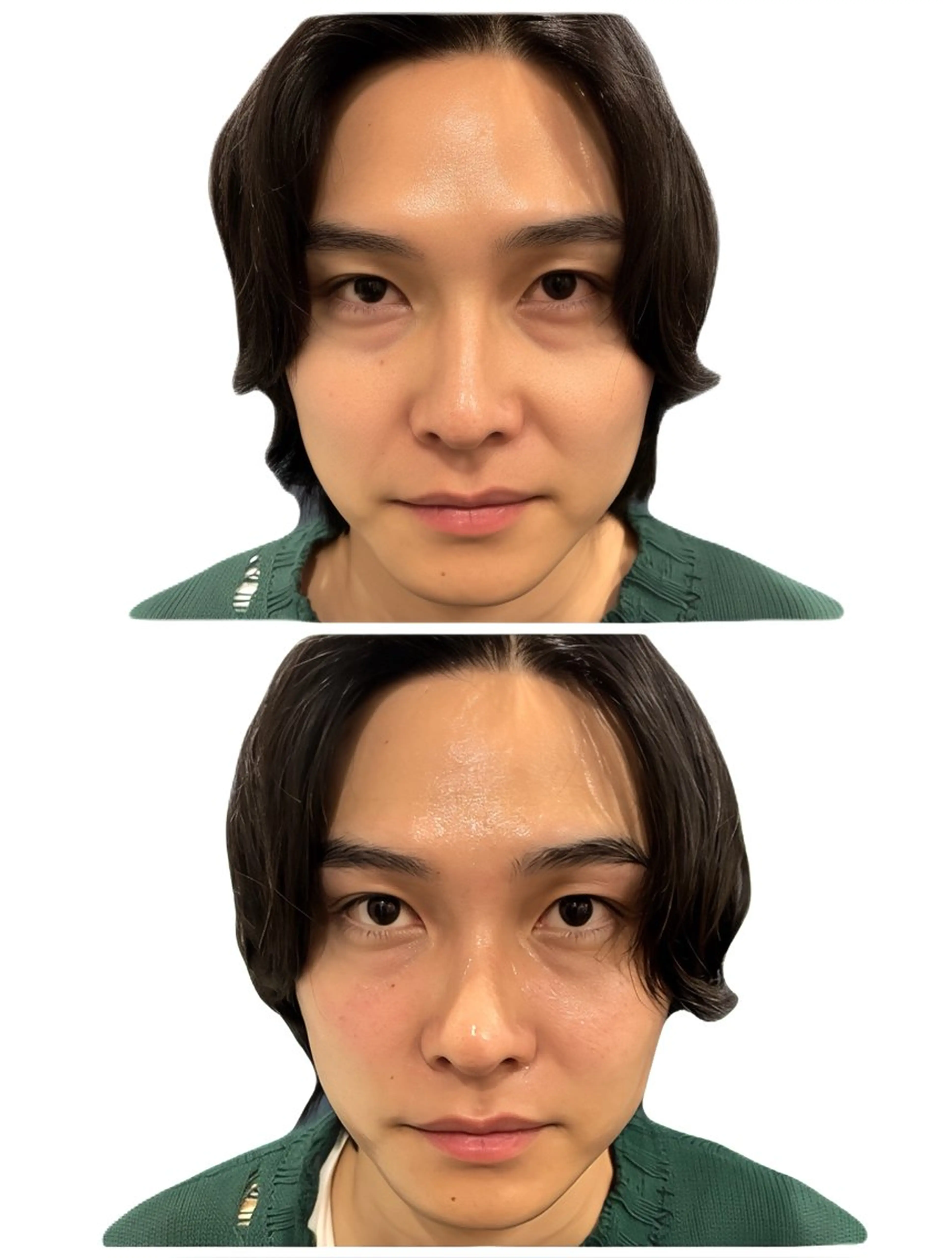 【たるみ脂肪余白スッキリ✨】小顔7step 130分　初回9,900円の写真