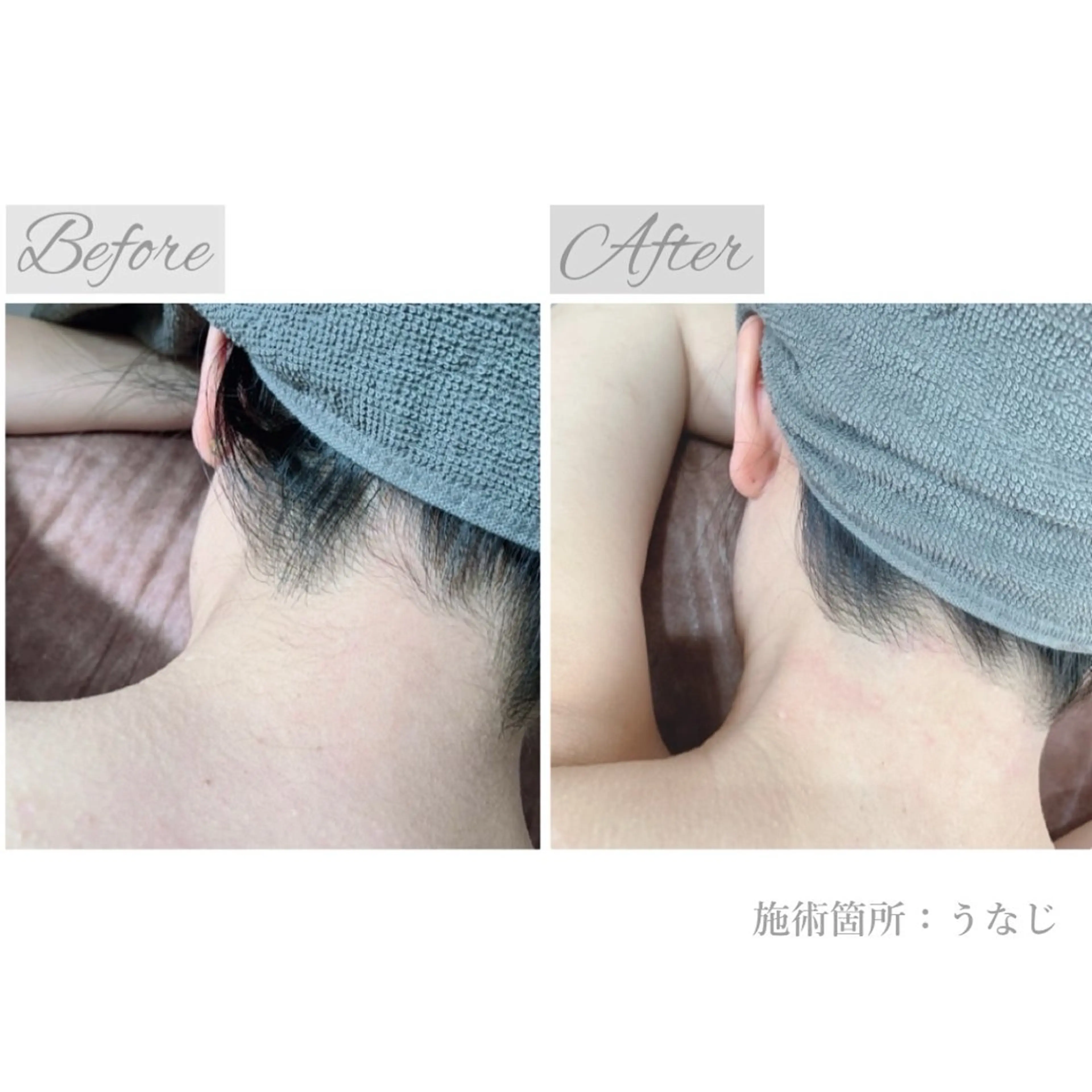 都度払い脱毛サロン Haleのエステ・リラクイメージ