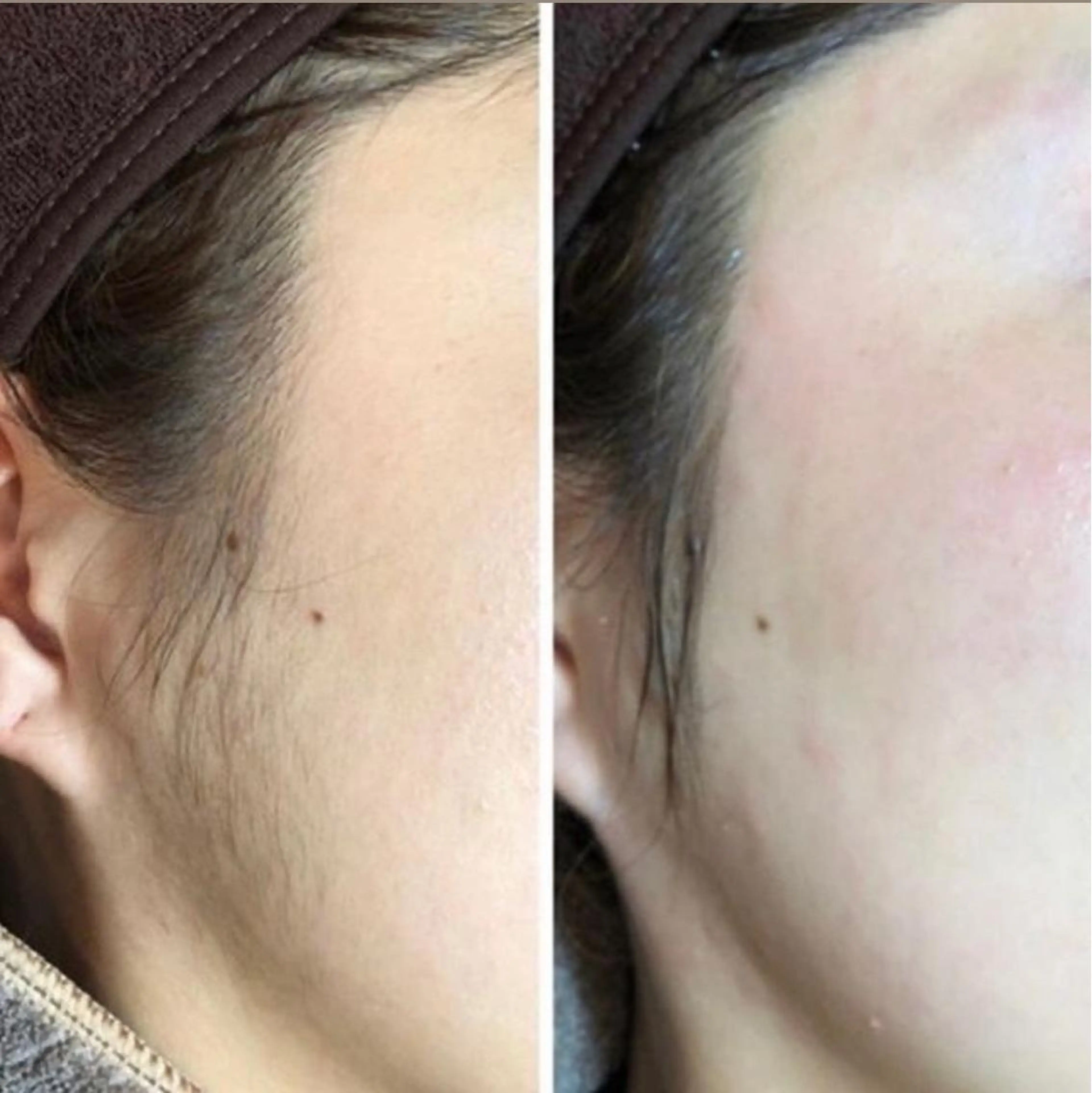 💠ﾂﾙｽﾍﾞお肌に𓂃𓈒𓏸︎︎︎︎ 🕊フェイスWAX脱毛💠の写真