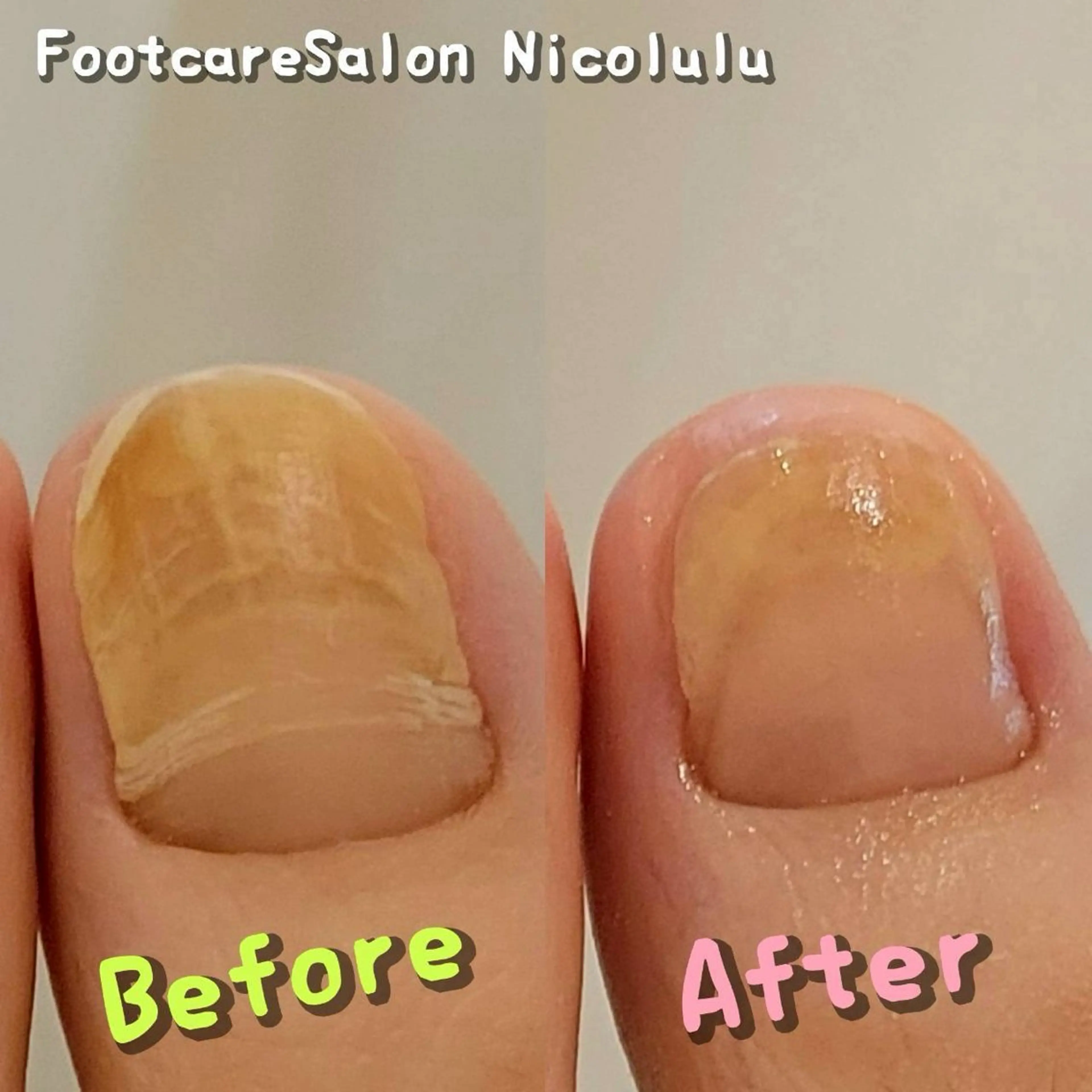 メンズ リラク 足トラブル専門 ニコルル金沢のエステ・リラクイメージ