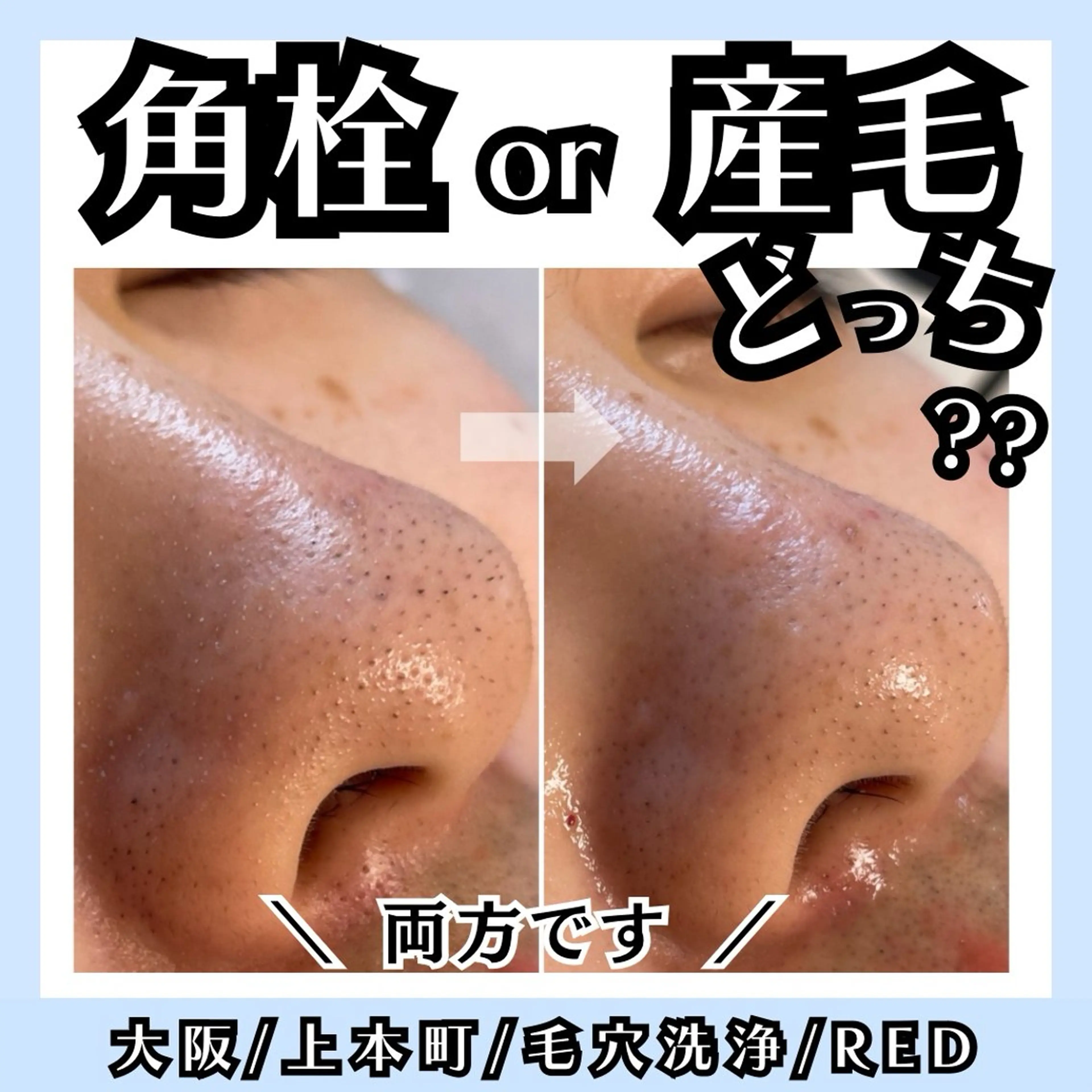 毛穴レス ハーブ＆ ワックス脱毛×光脱毛のエステ・リラクイメージ