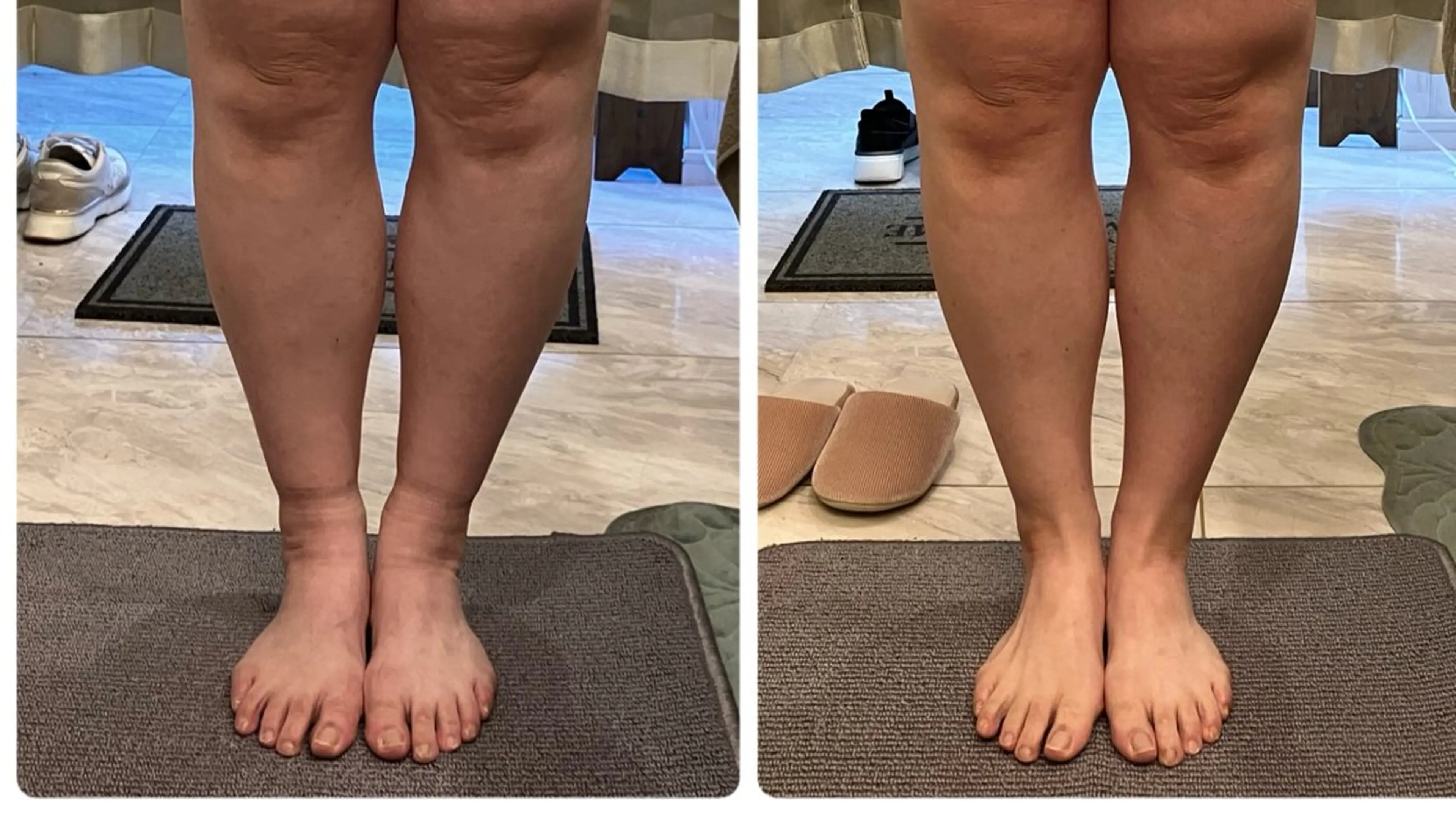 エステ リラク Infinity -Kayo-のその他イメージ