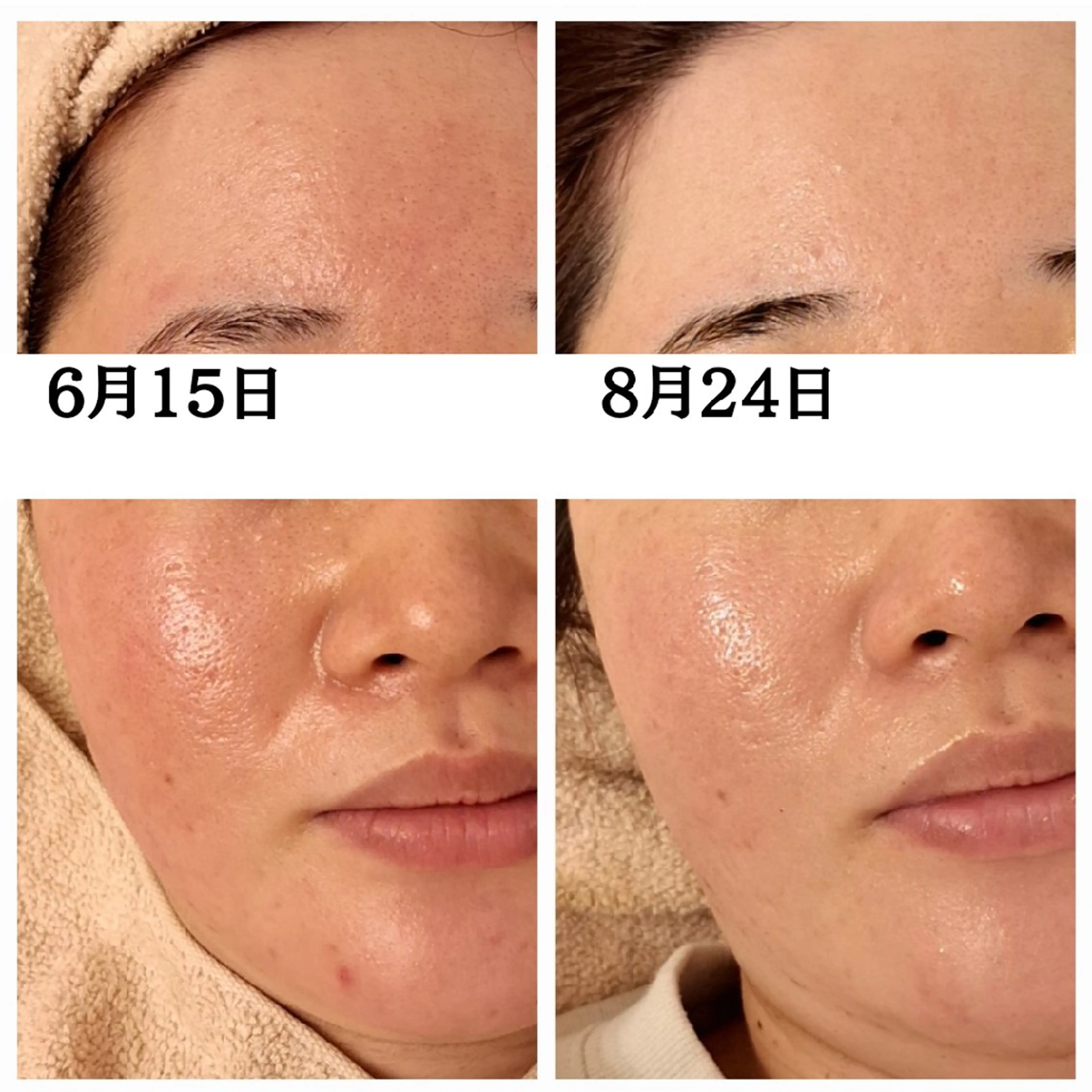 フェイシャル専門サロ ン　ERINのエステ・リラクイメージ