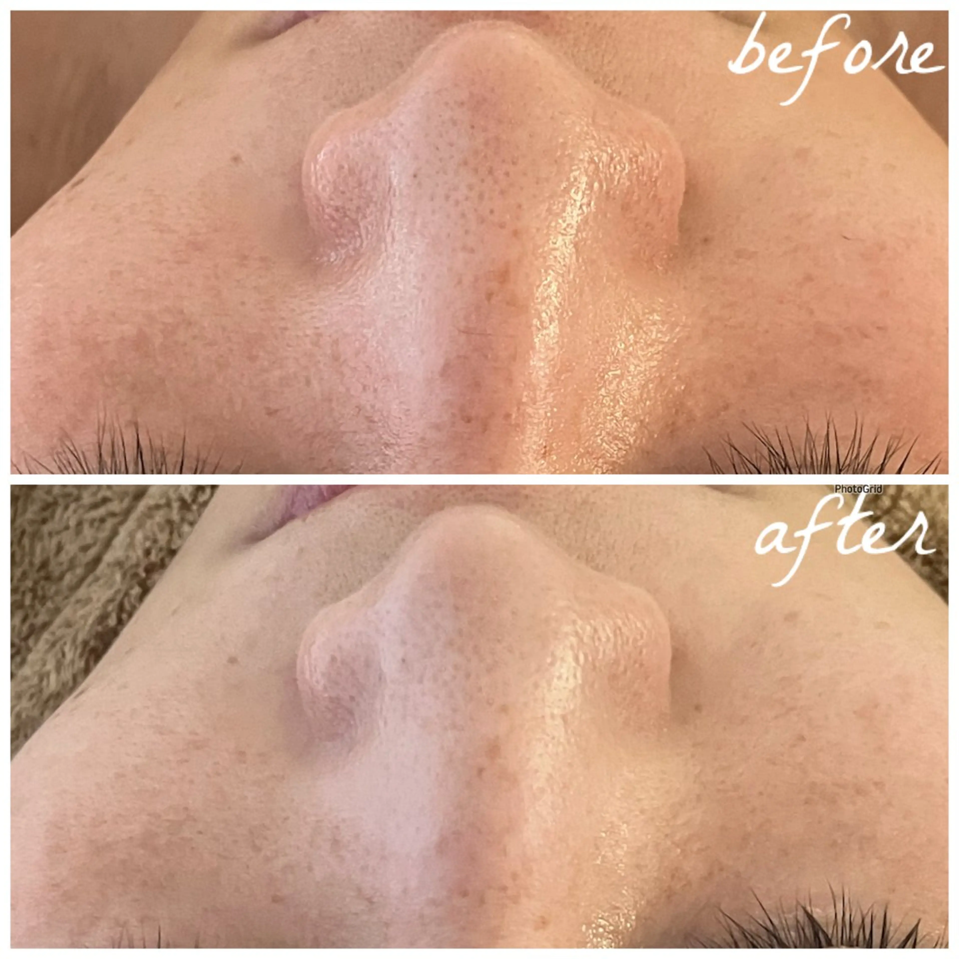 メンズ エステ メナード岐阜茜部 杉浦のエステ・リラクイメージ