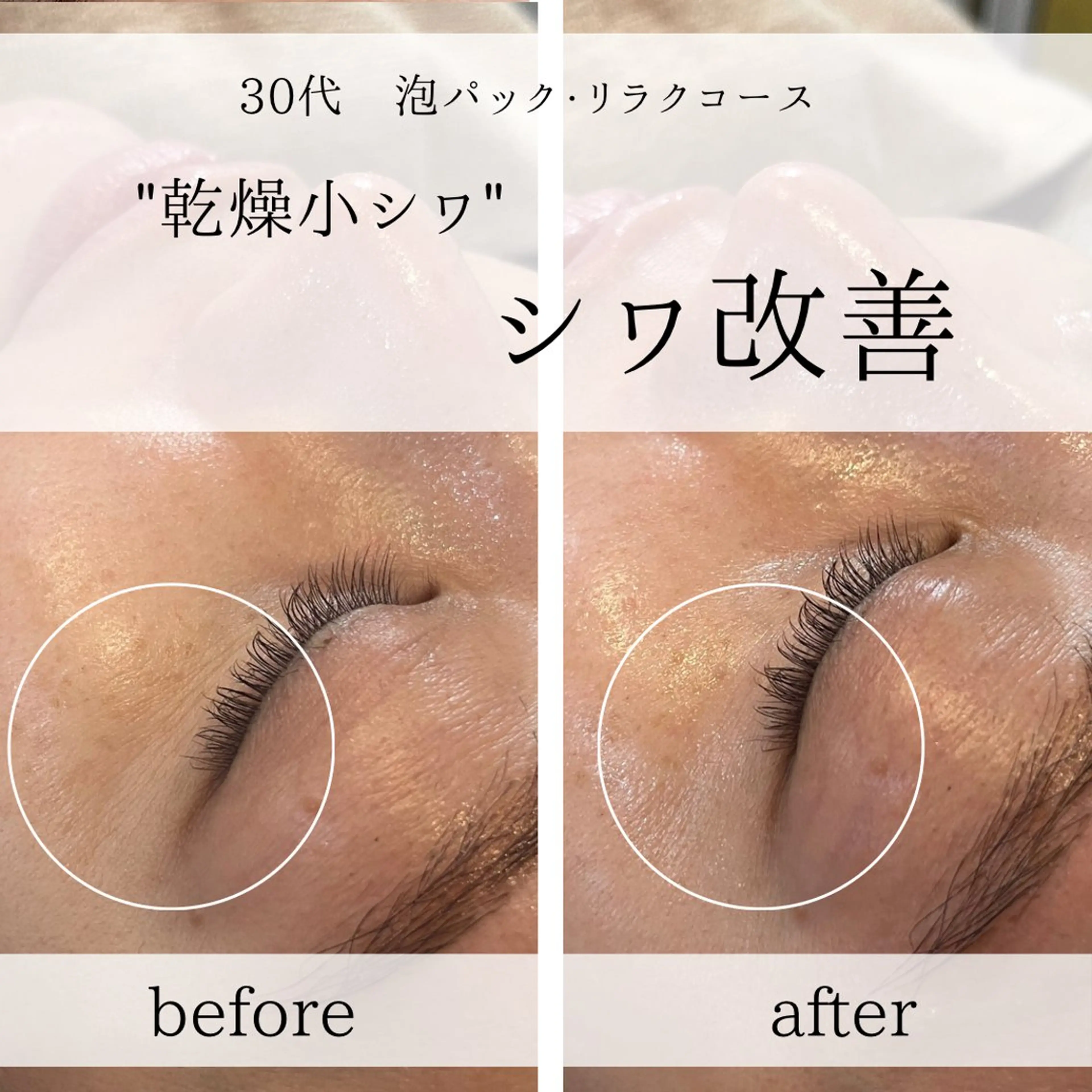 yc.hacci 【ハーブピーリング】の眉毛・アイブロウイメージ