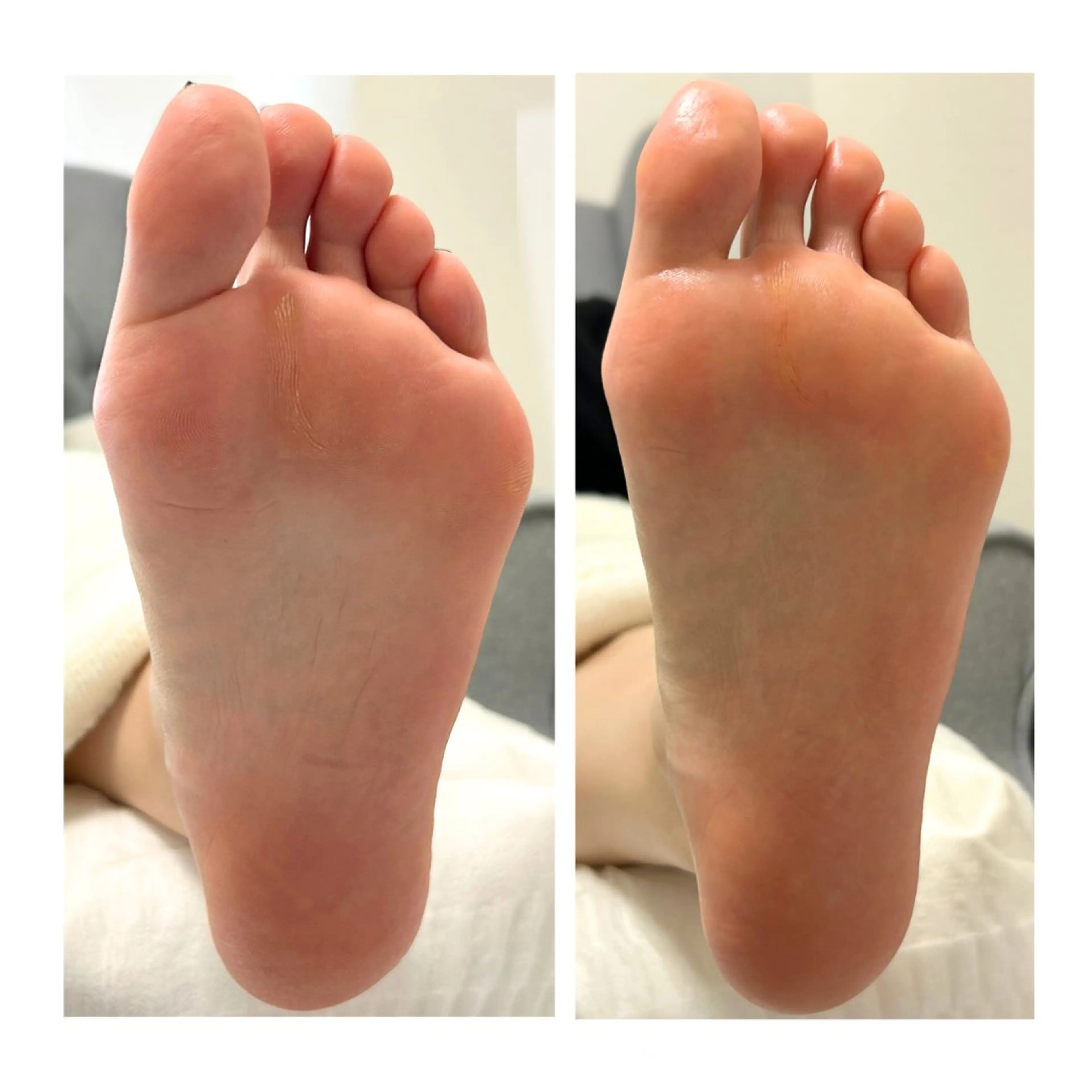 ［フットケア］ベーシックコースの写真