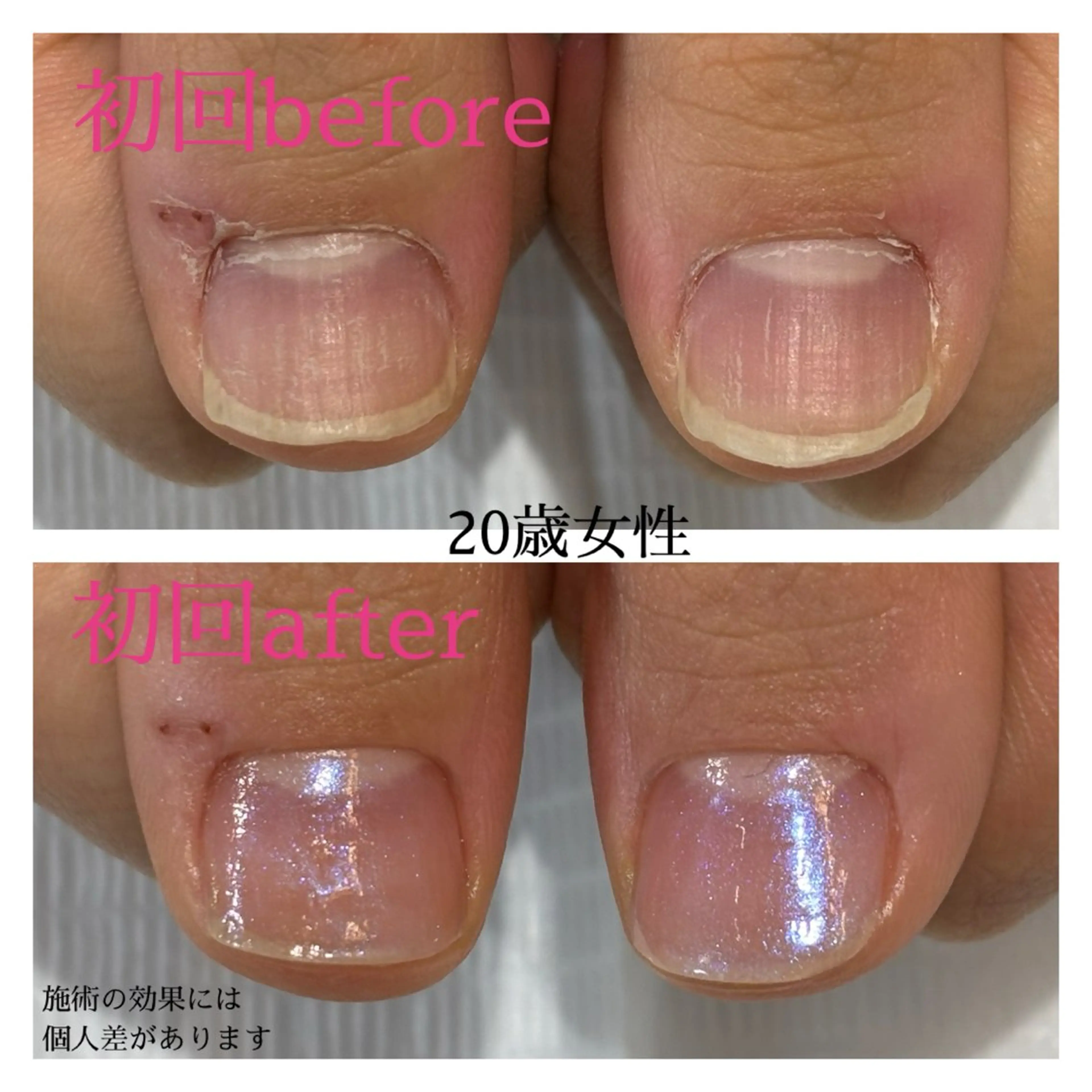 ネイル 自爪育成専門サロン エムロードゥ池下のネイルデザイン