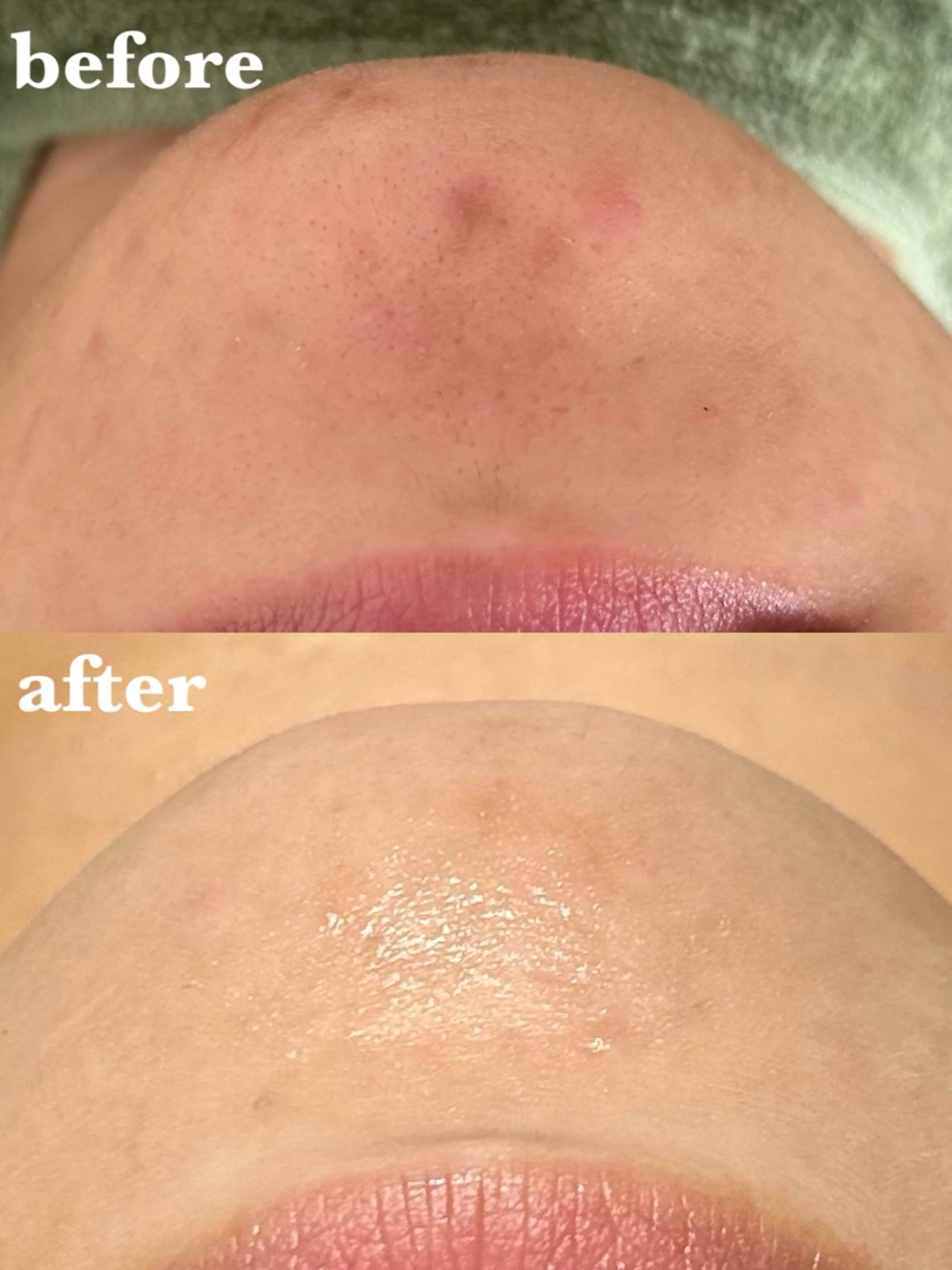 【ハーブピーリングお試し体験価格】陶肌トリートメント『お顔』¥5,500(陶肌パウダー半量)の写真