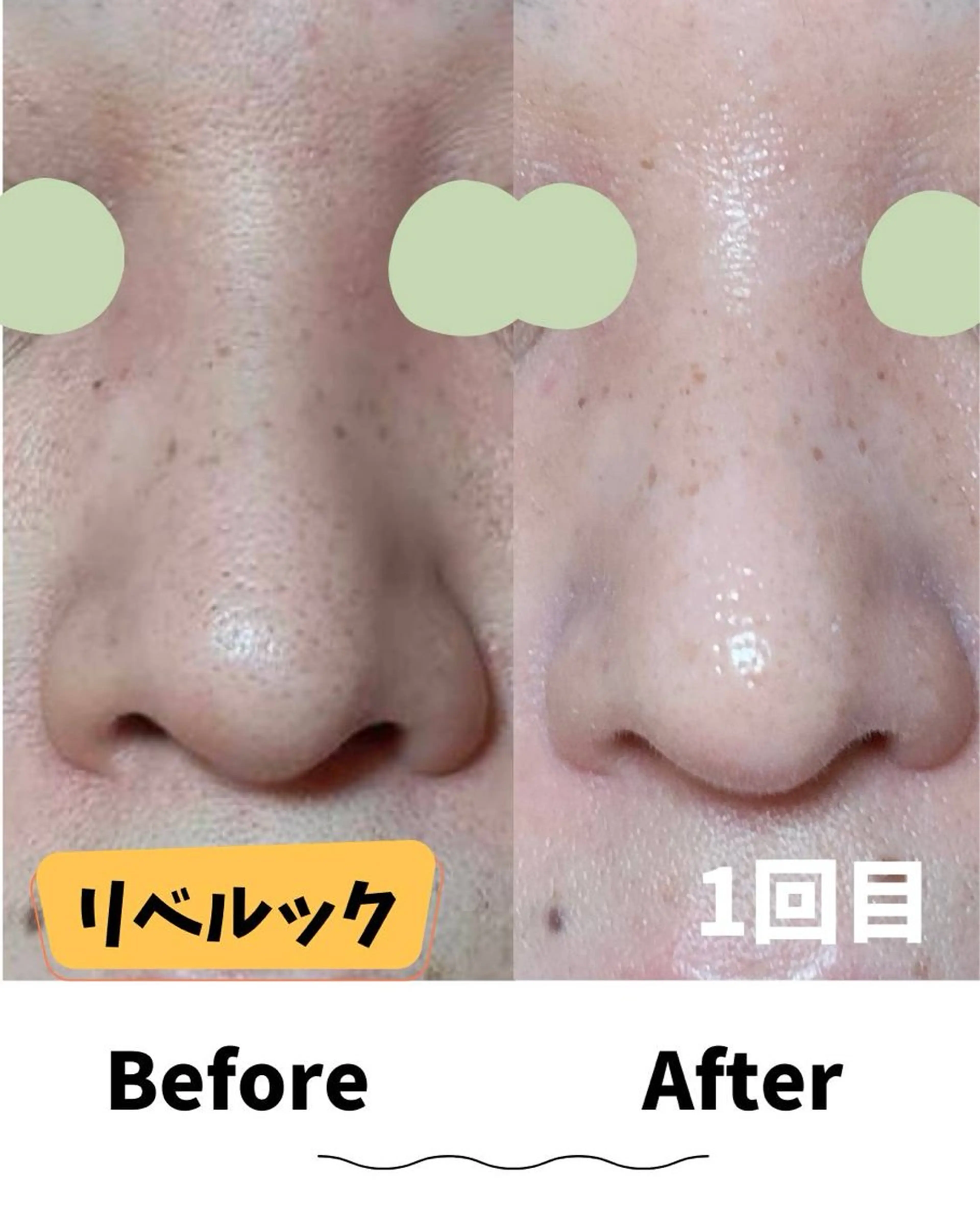 エステ コンセプトサロン〜友〜所属・コンセプトサロン友 木下のエステ・リラクイメージ