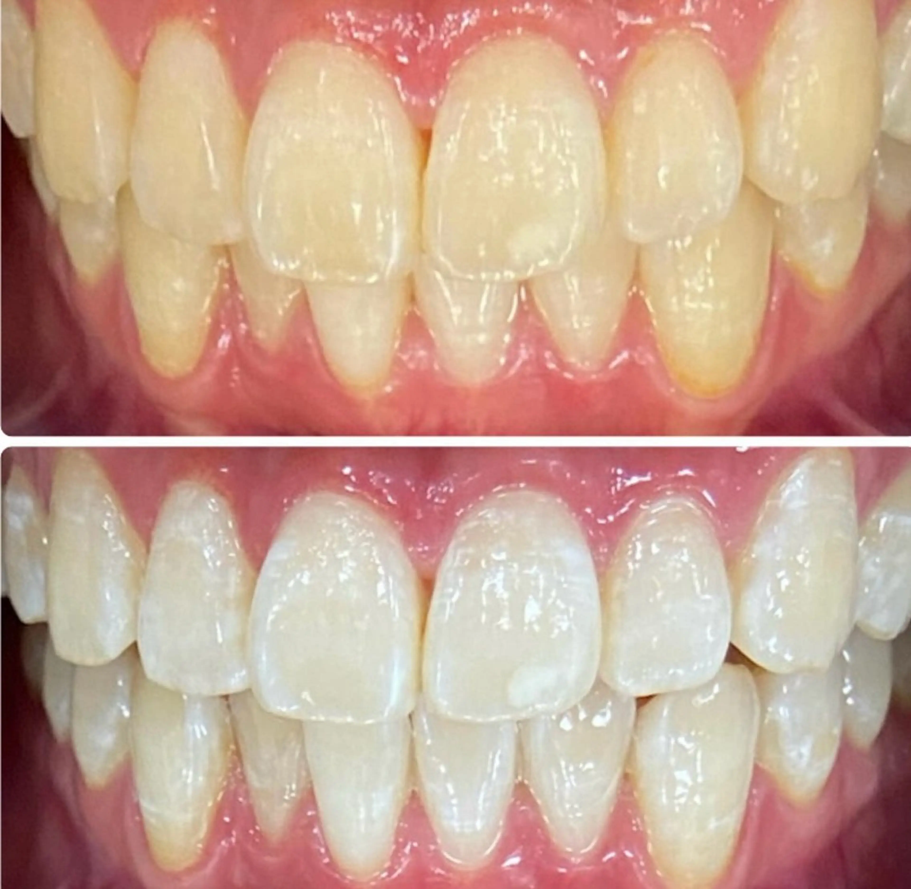 ホワイトニングルーム 横浜店のその他イメージ