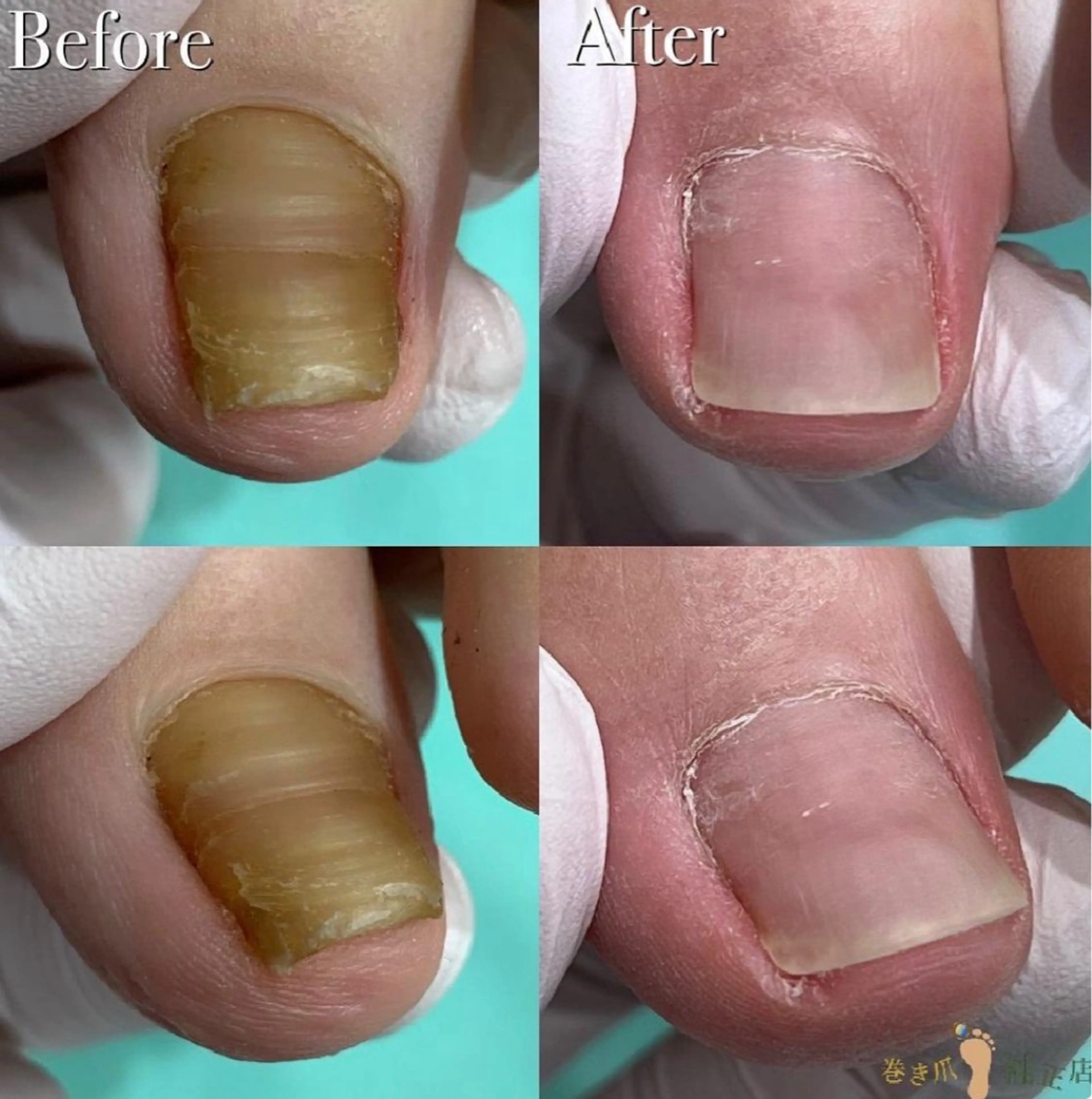 リラク 福岡巻き爪補正店 博多店のエステ・リラクイメージ