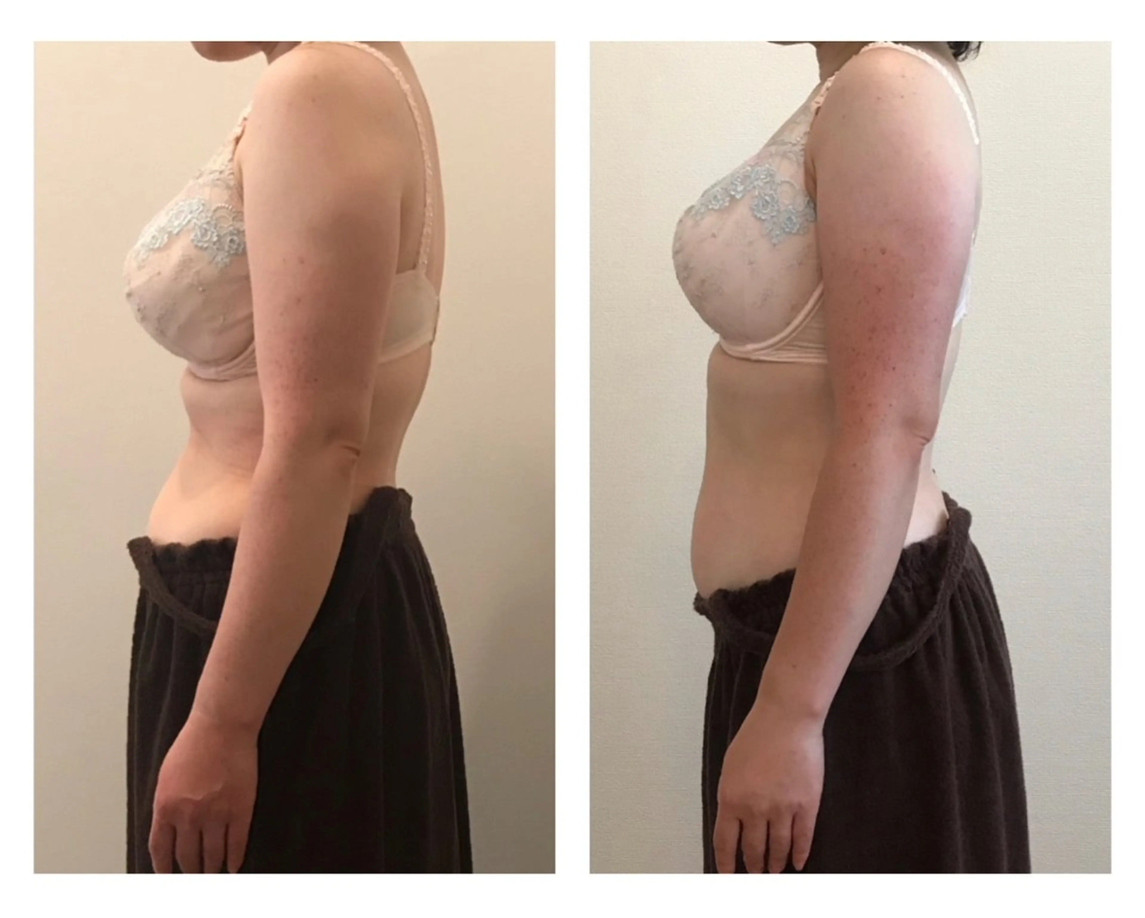 【初回限定】何やっても痩せない人向け！ダイエットコースの写真