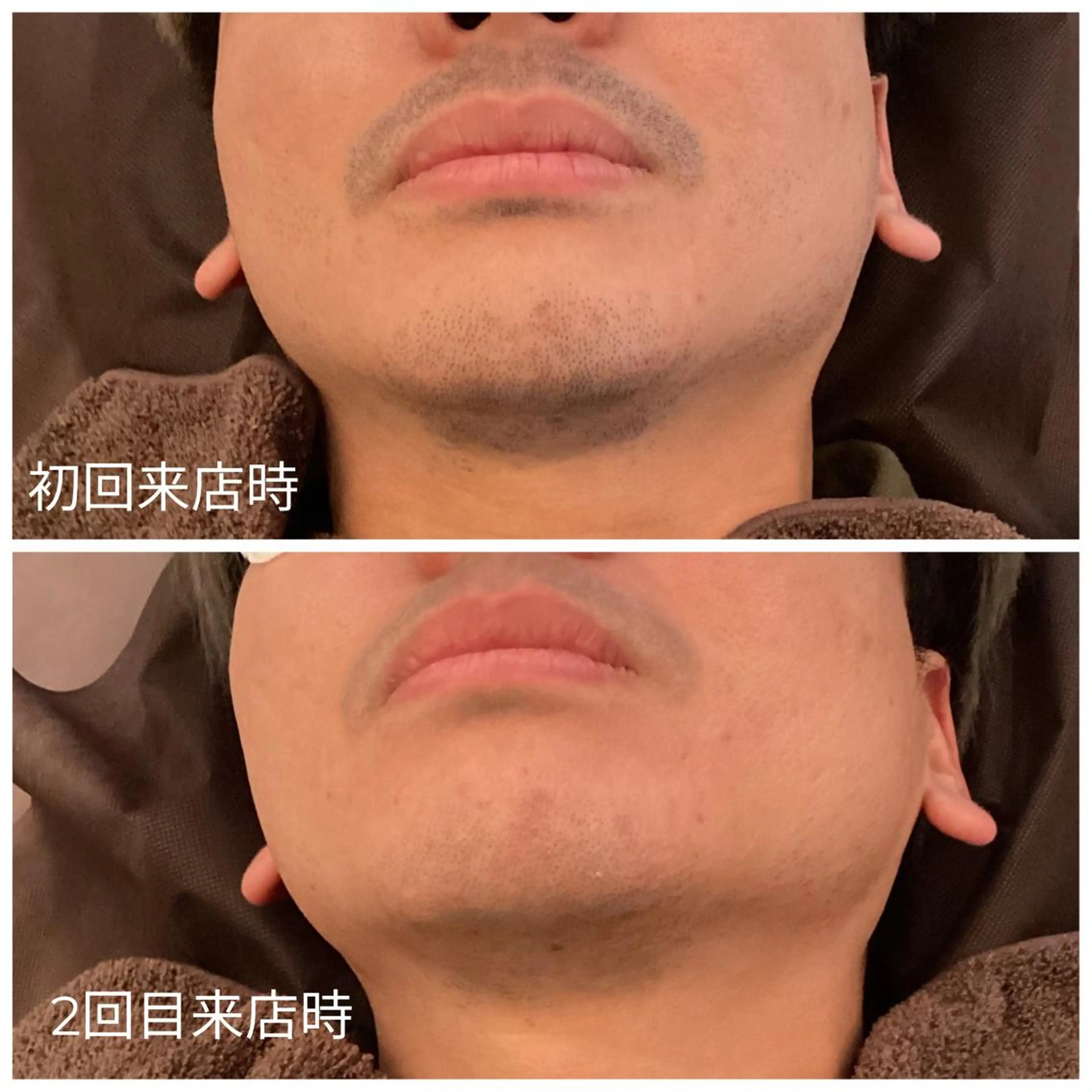 メンズ men's脱毛サロン ECXIAのエステ・リラクイメージ