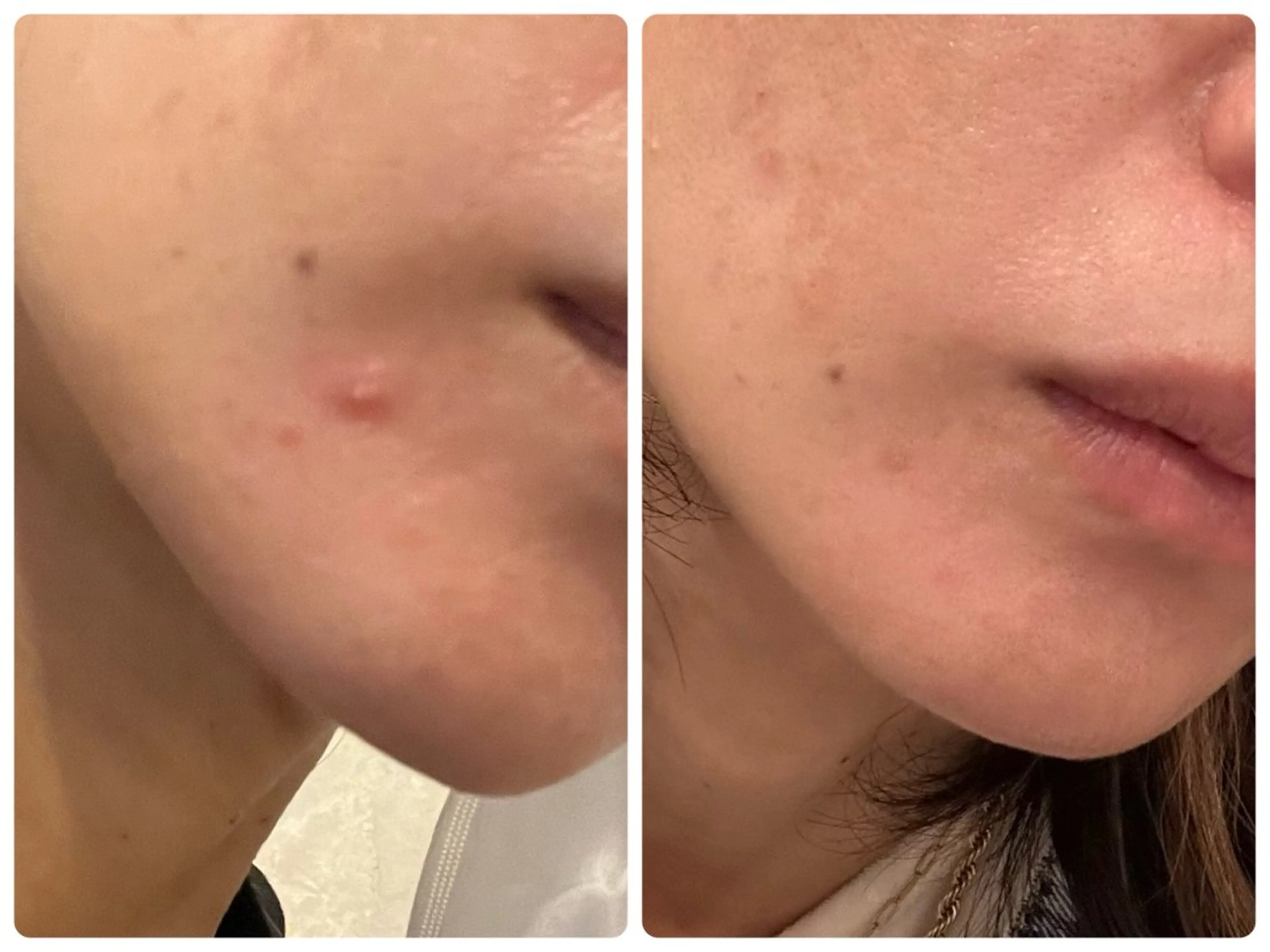 エステ yellow💛【 脱毛&フェイシャル】のエステ・リラクイメージ