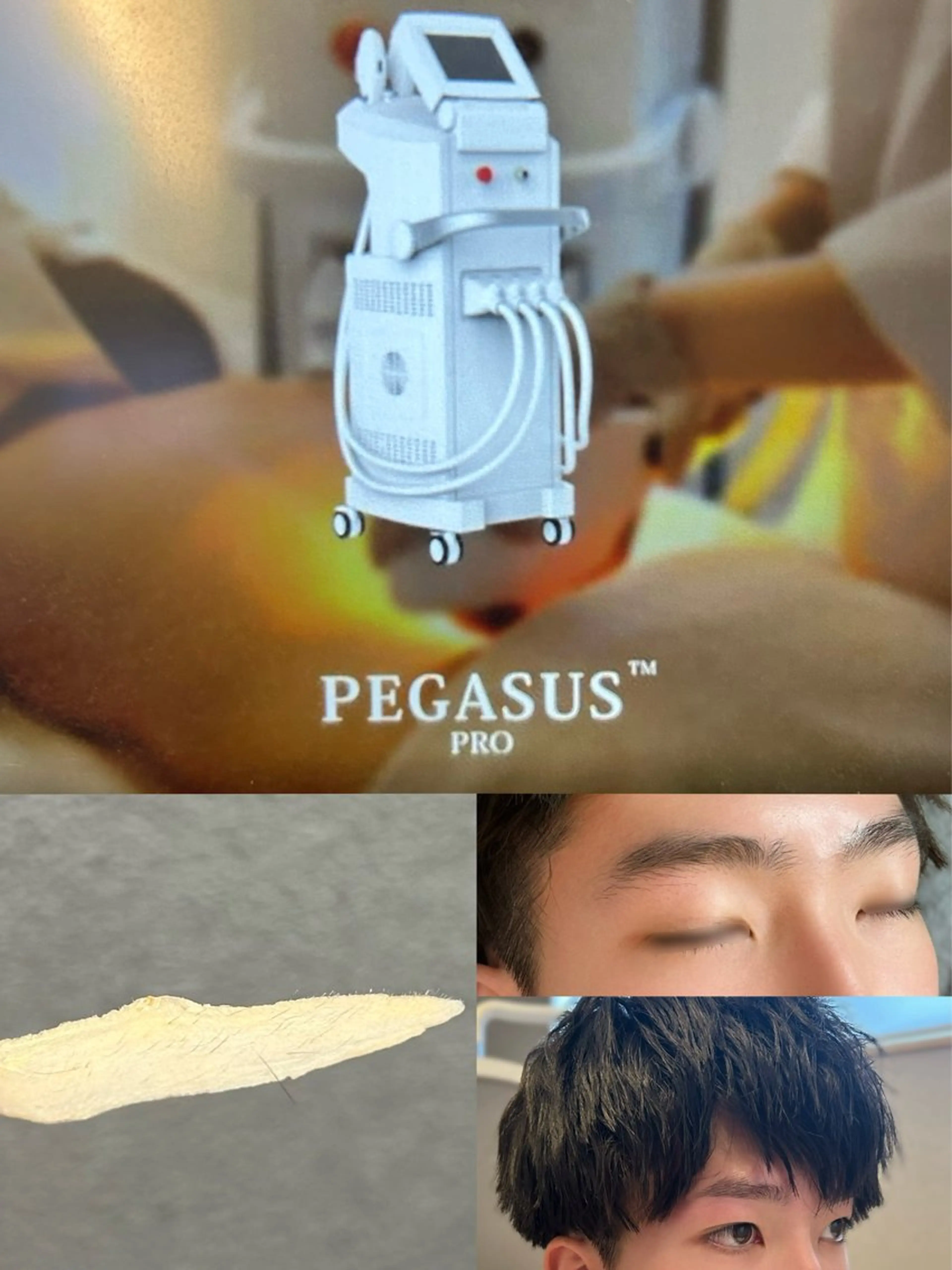 男性限定🆕新メニュー✨眉毛、脱毛(ヒゲ＋腕)、一部分ワックスセット🙌🏻🌼の写真