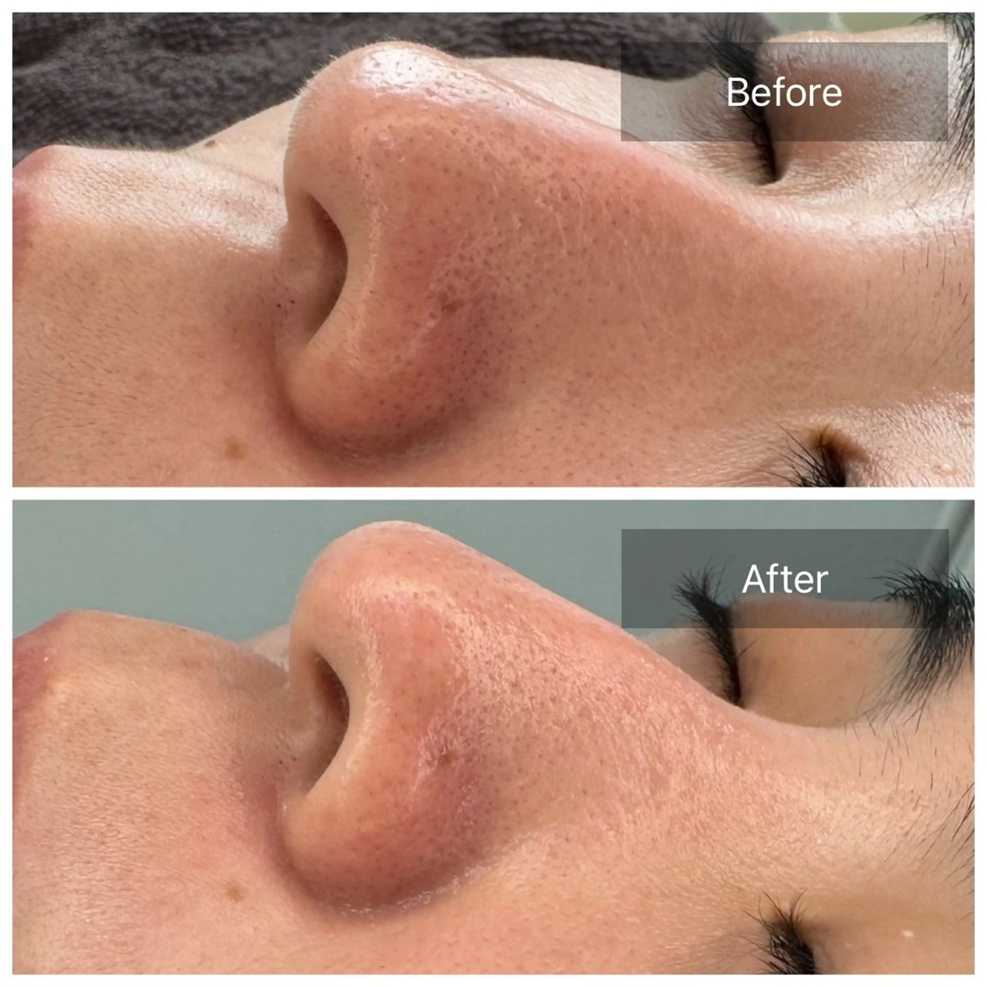 脱毛 トータルしみケア専門 NICA(ニカ)の眉毛・アイブロウイメージ