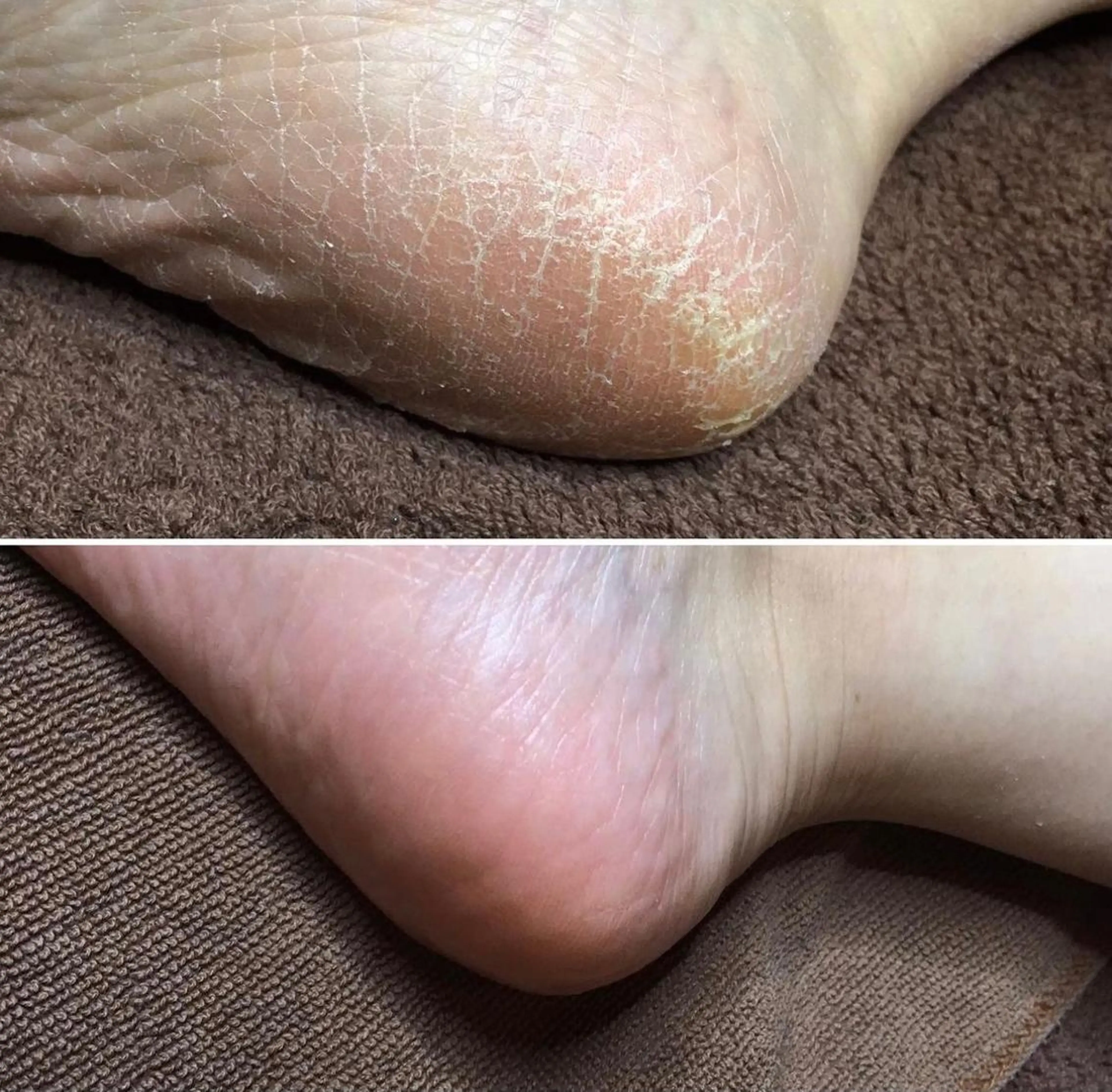 ネイル 痩身/脱毛/ネイル HARUKAのエステ・リラクイメージ