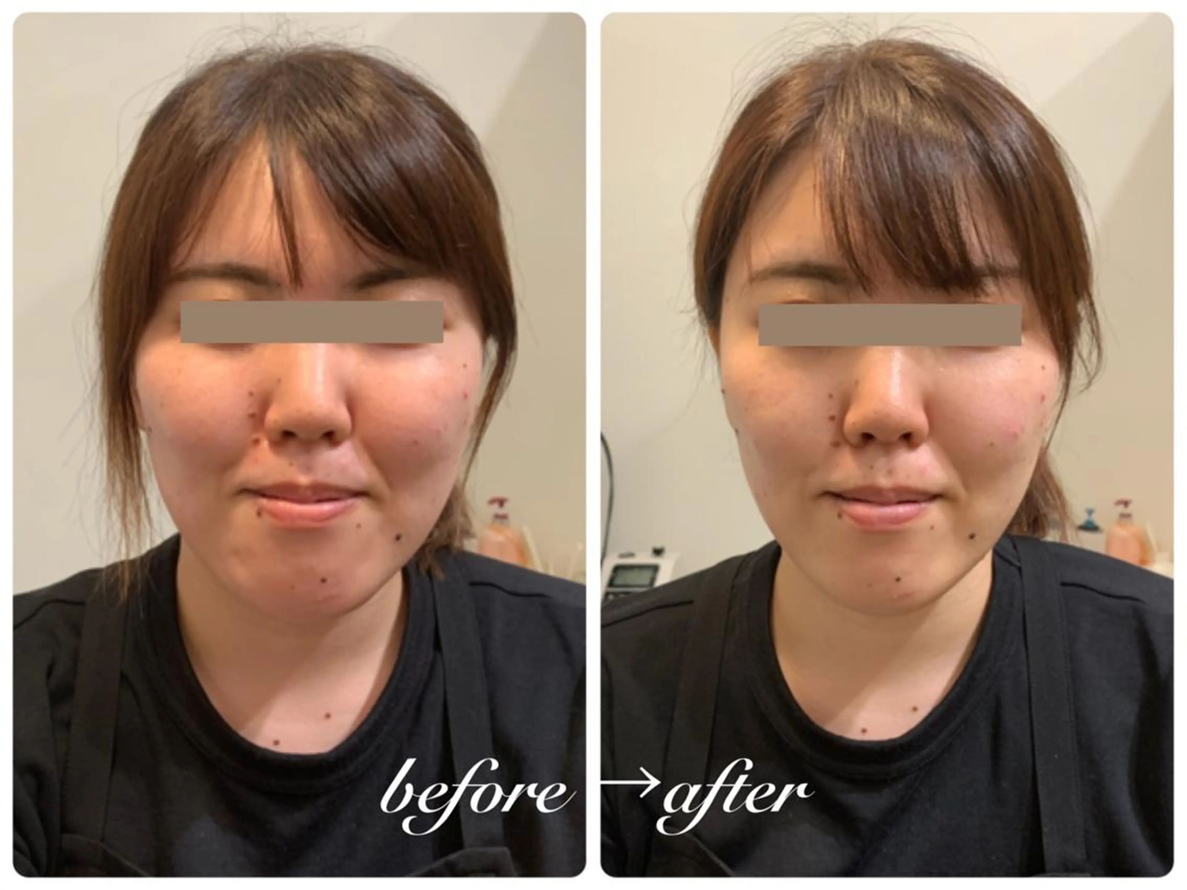 エステ 痩身脱毛専門店 Partirのエステ・リラクイメージ