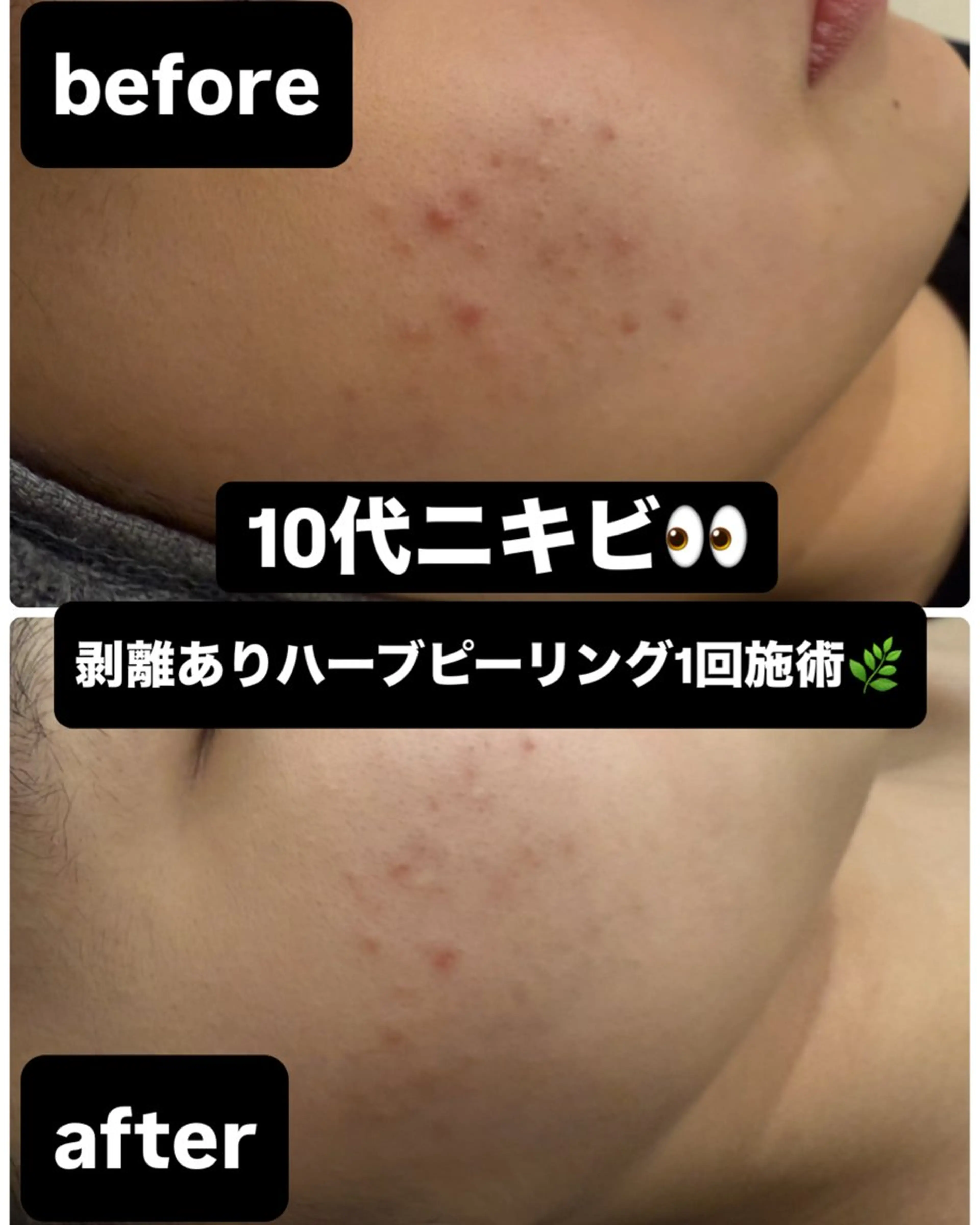 キッズ NHerb【エヌハーブ】所属・横田 汐里のネイルデザイン