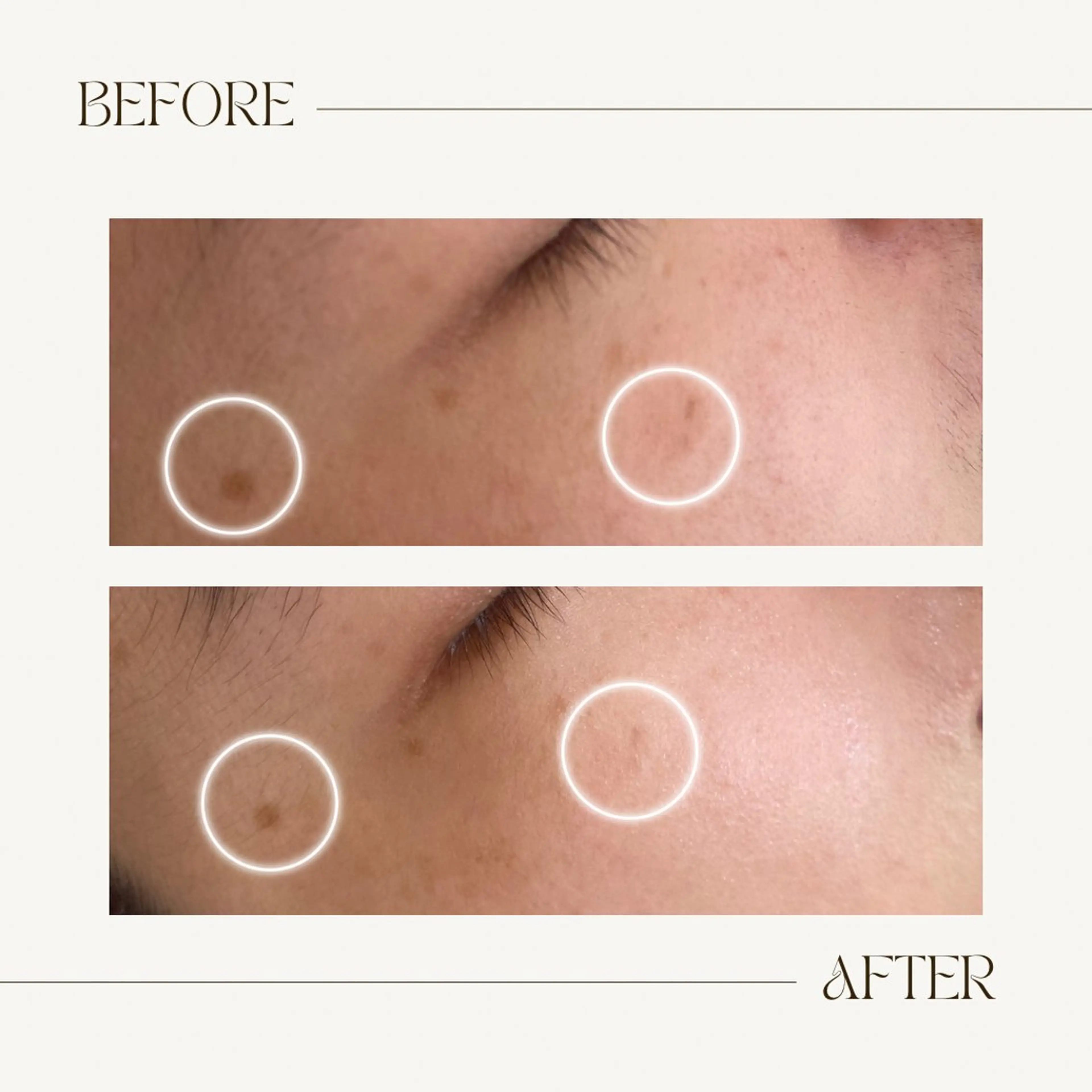 CEsalonEgg 齋藤のエステ・リラクイメージ