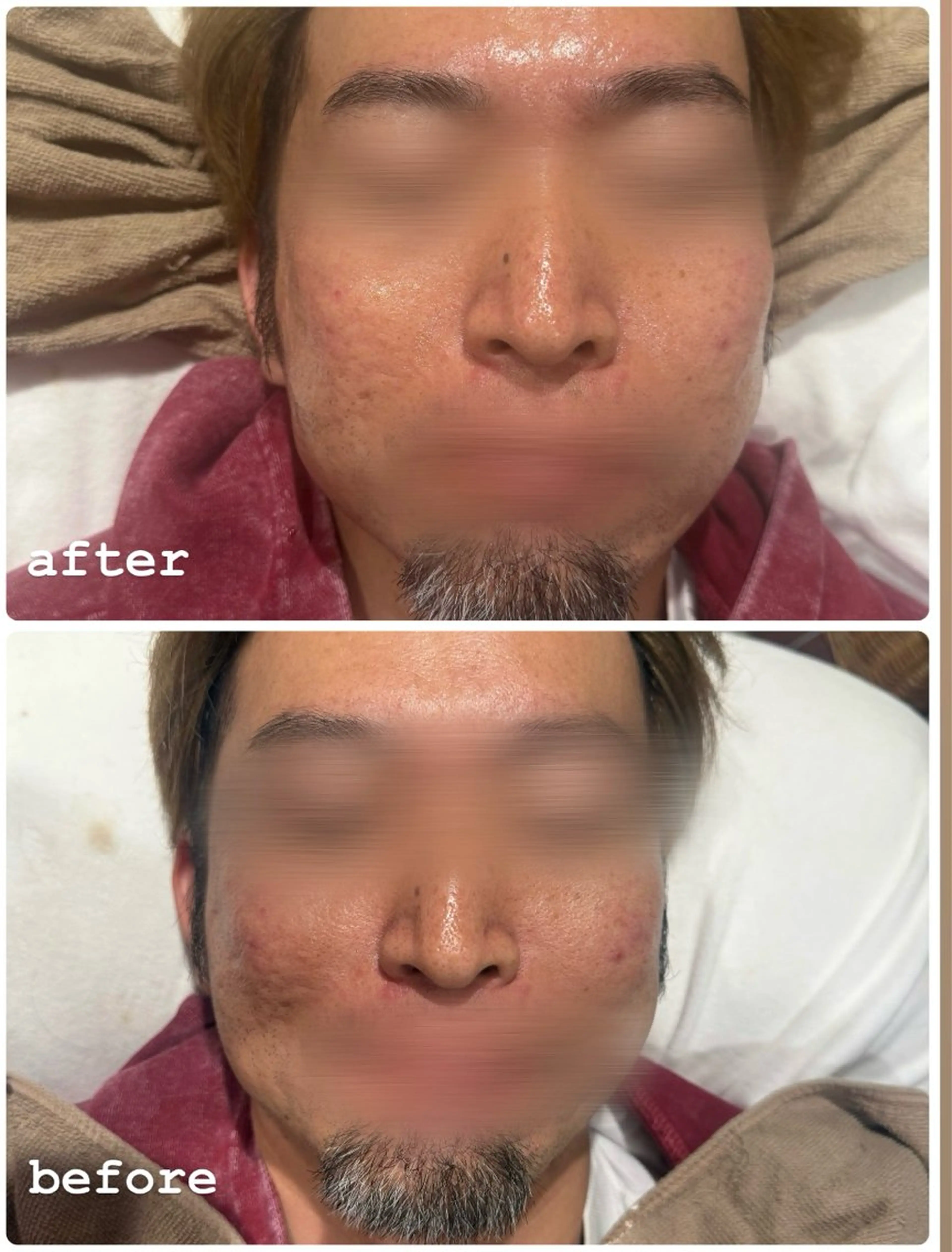 エステ 伊賀 穂奈美のエステ・リラクイメージ