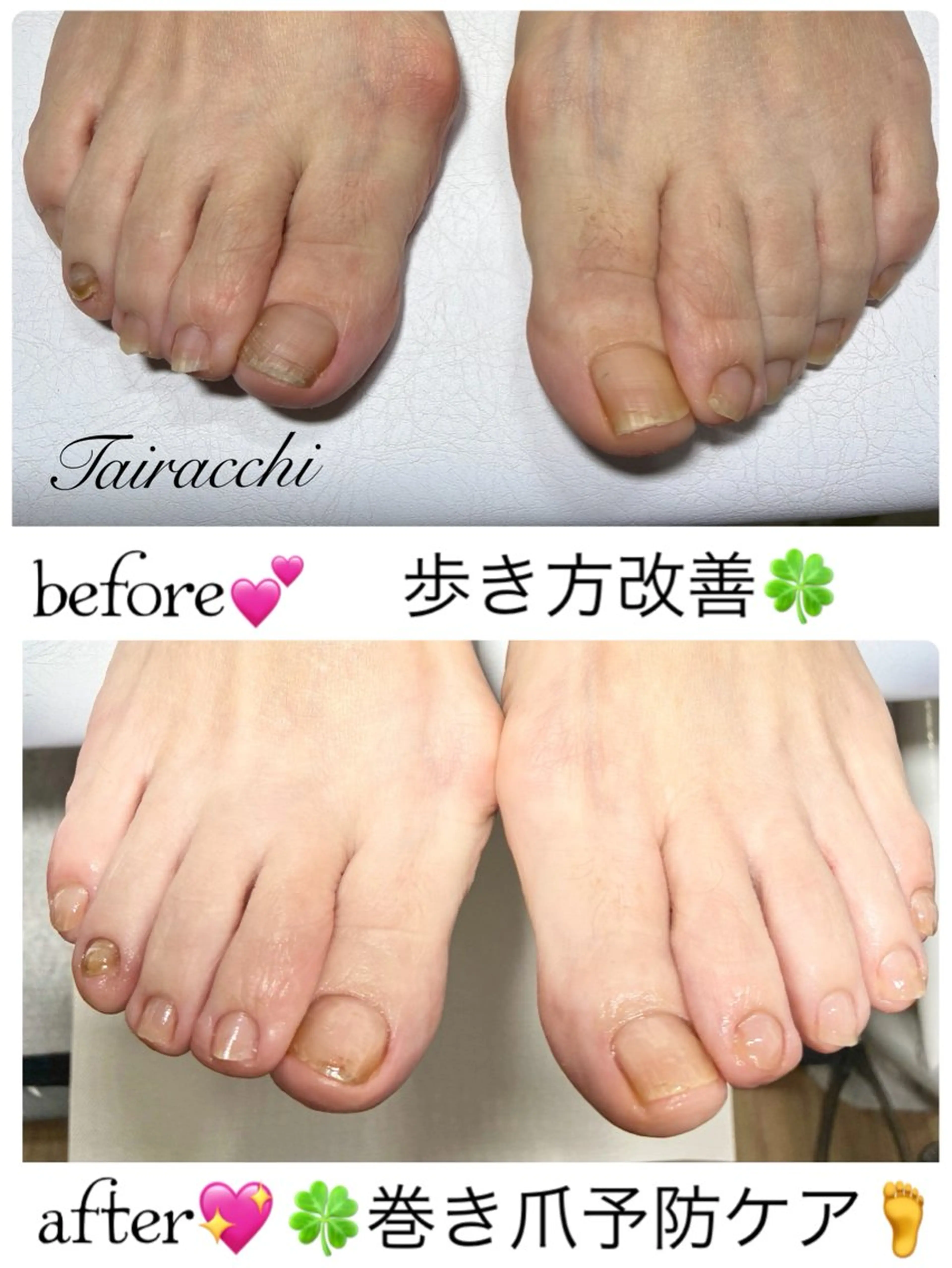 ネイル フットネイル フットネイル Tairacchi タイラッチのエステ・リラクイメージ