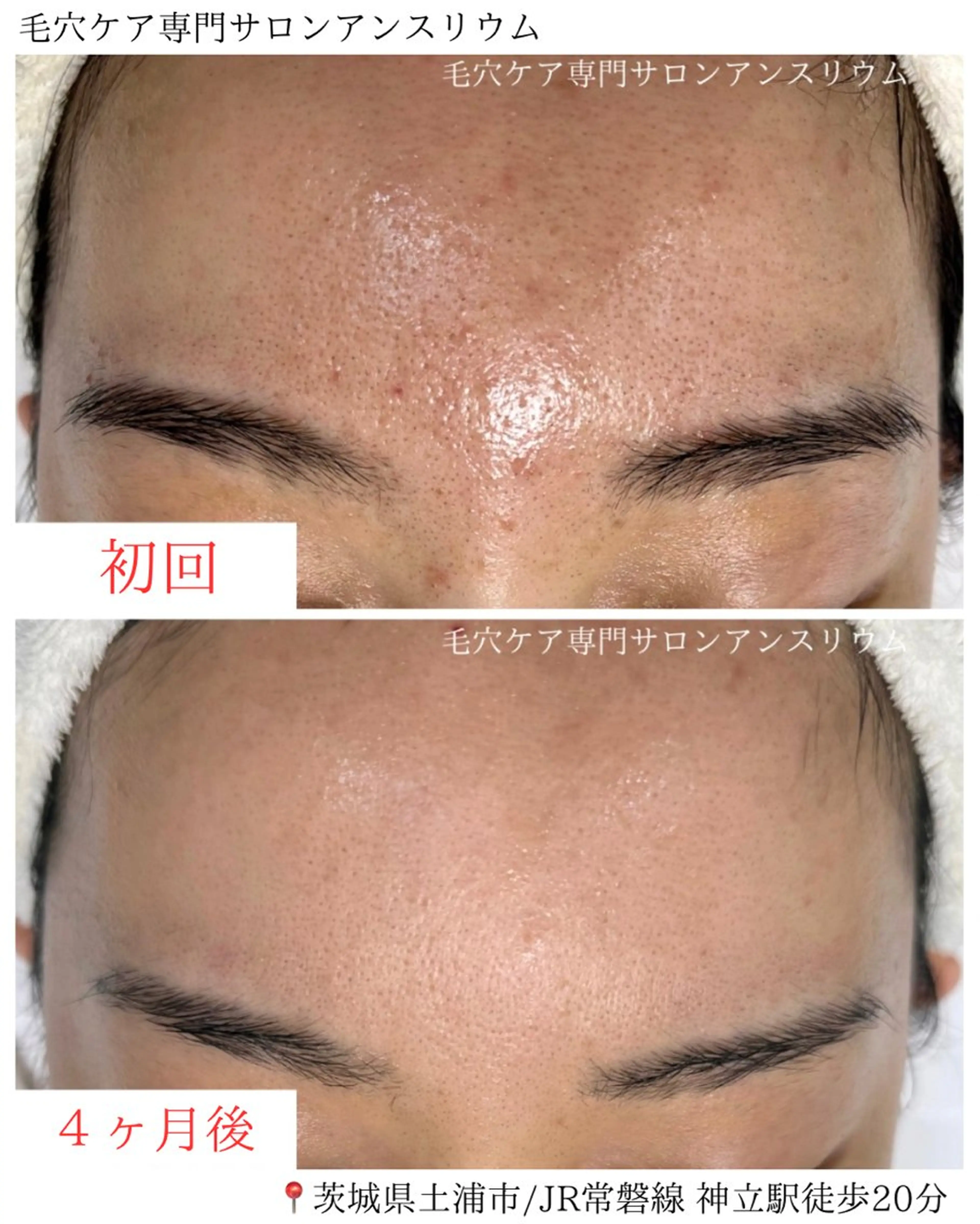 茨城土浦 つくば毛穴 ケア専門サロンのエステ・リラクイメージ