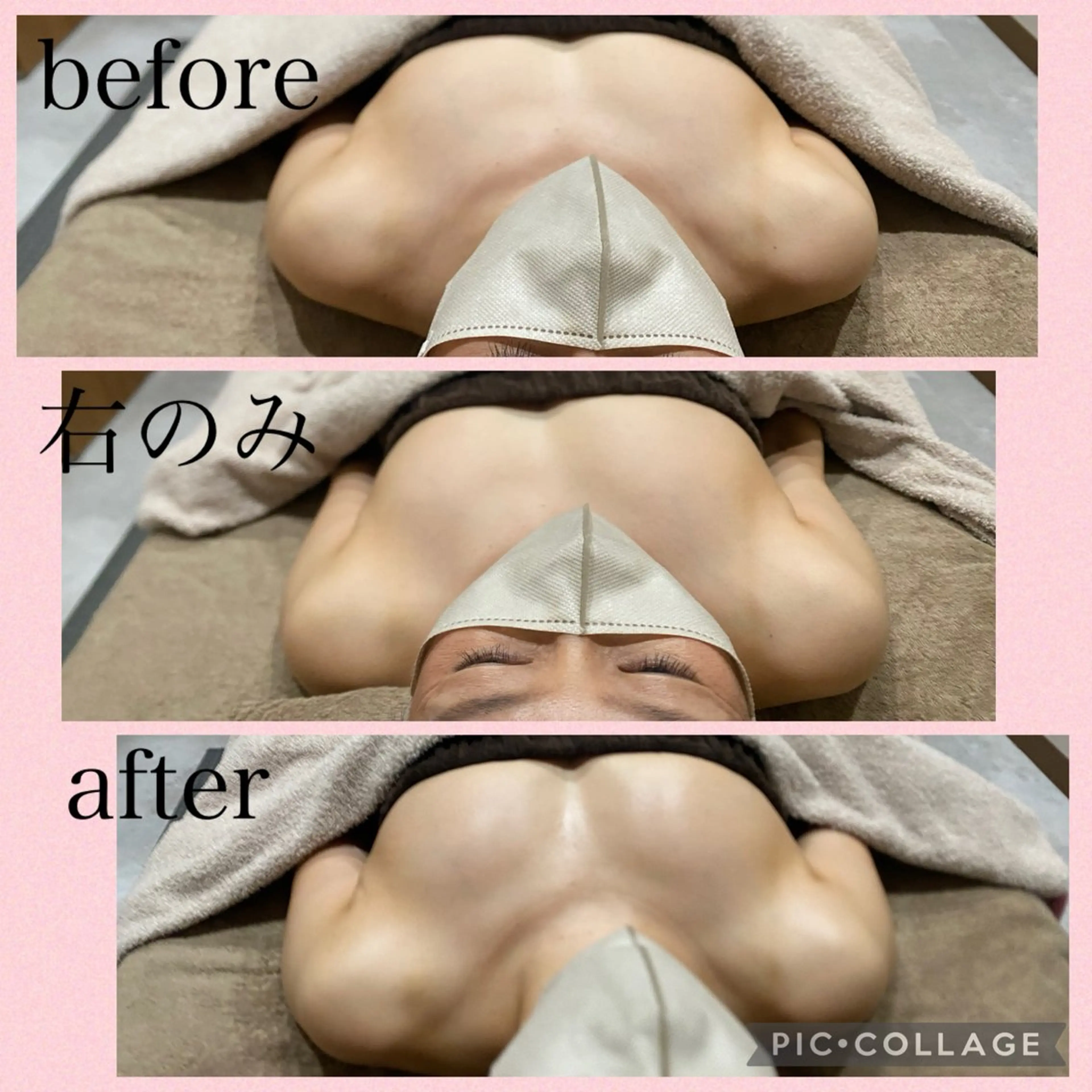 【ふっくらハリのあるバストへ】二の腕・デコルテ・背中すっきり◎上半身集中コース(ボンボンバスト技法)の写真