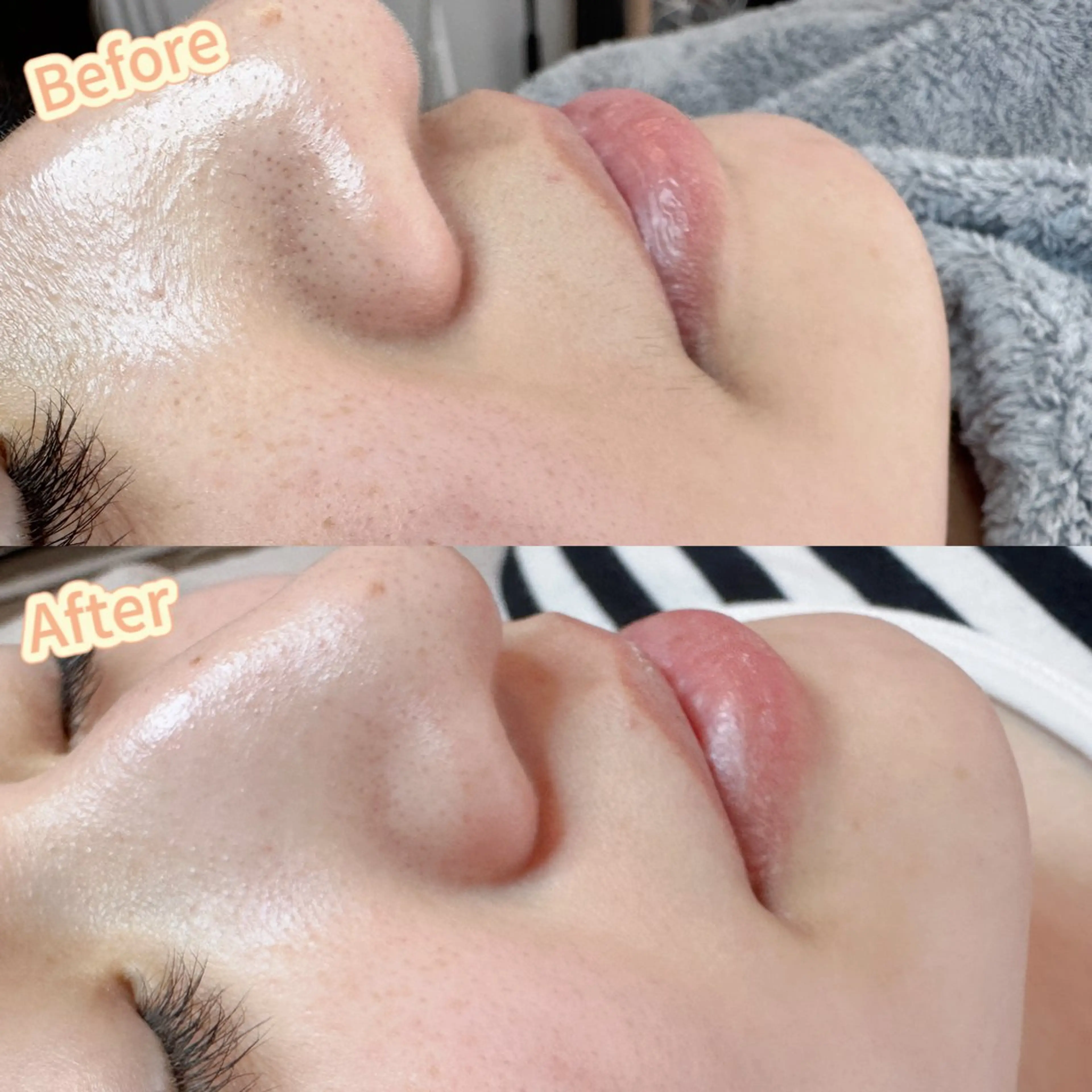 Hitomi シュガーリング豊橋のその他イメージ