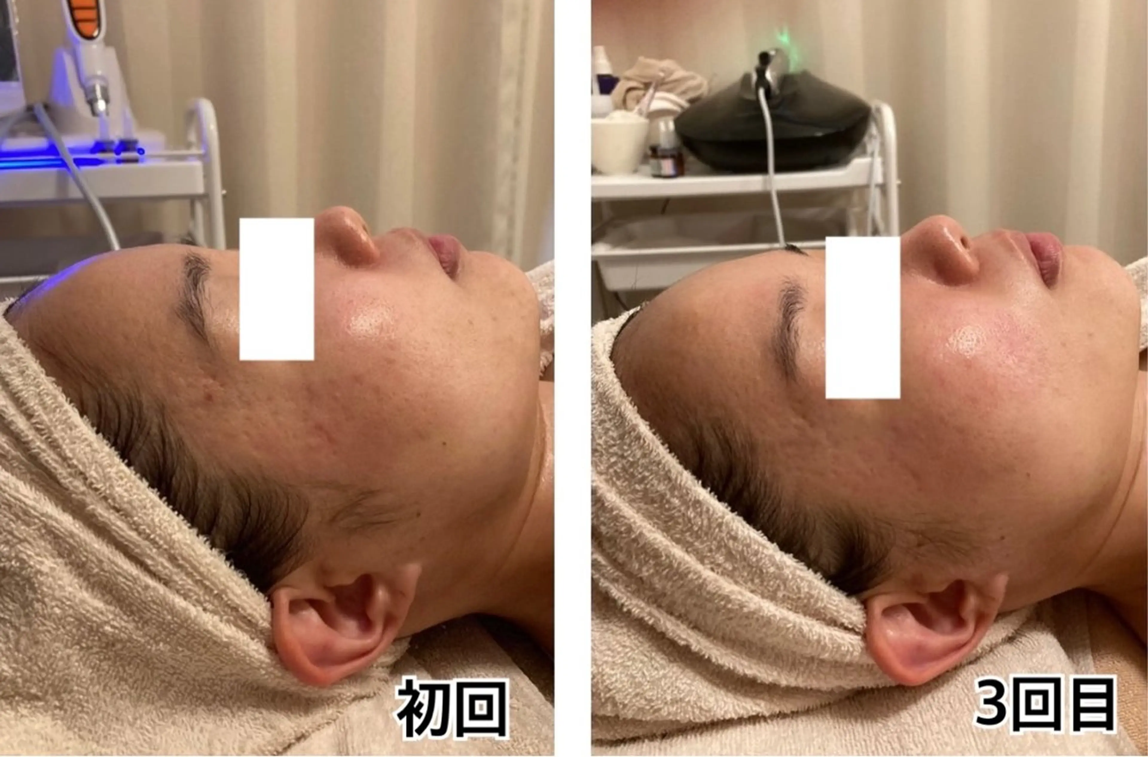 エステ ポテンツァ&針美容 バストアップ専門店のエステ・リラクイメージ