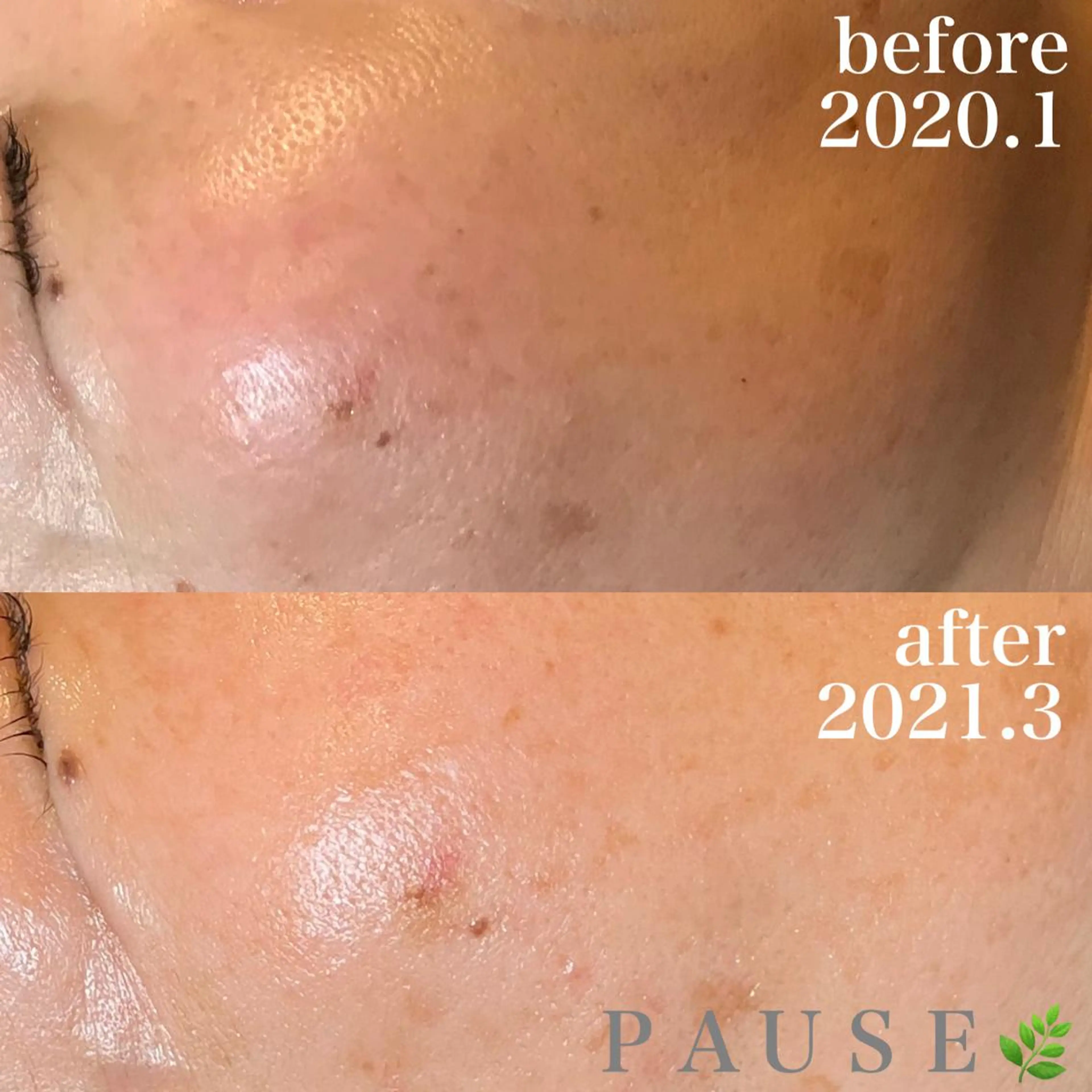 エステ リラク 浜野 恵美のエステ・リラクイメージ