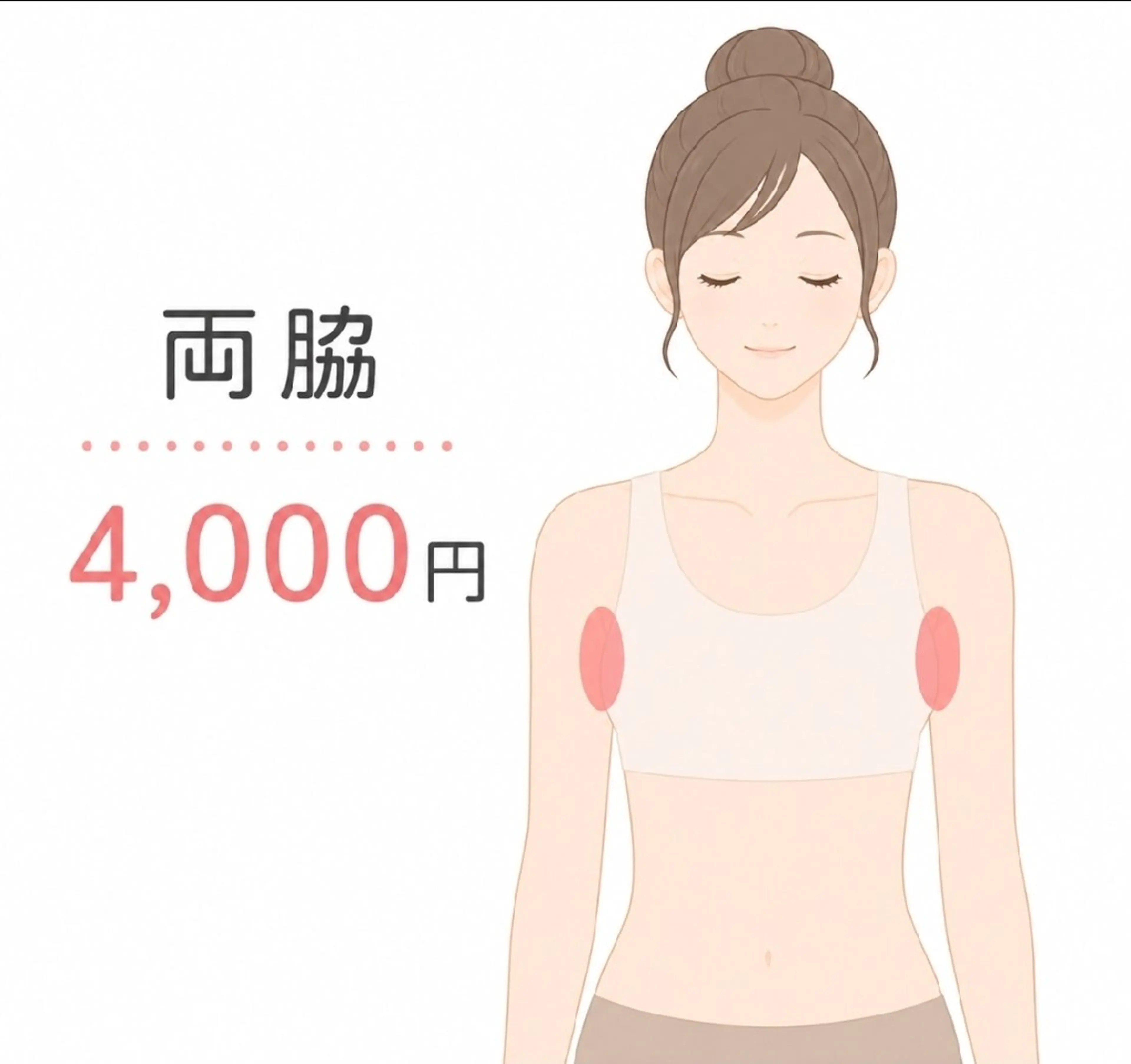 光脱毛【両脇】の写真