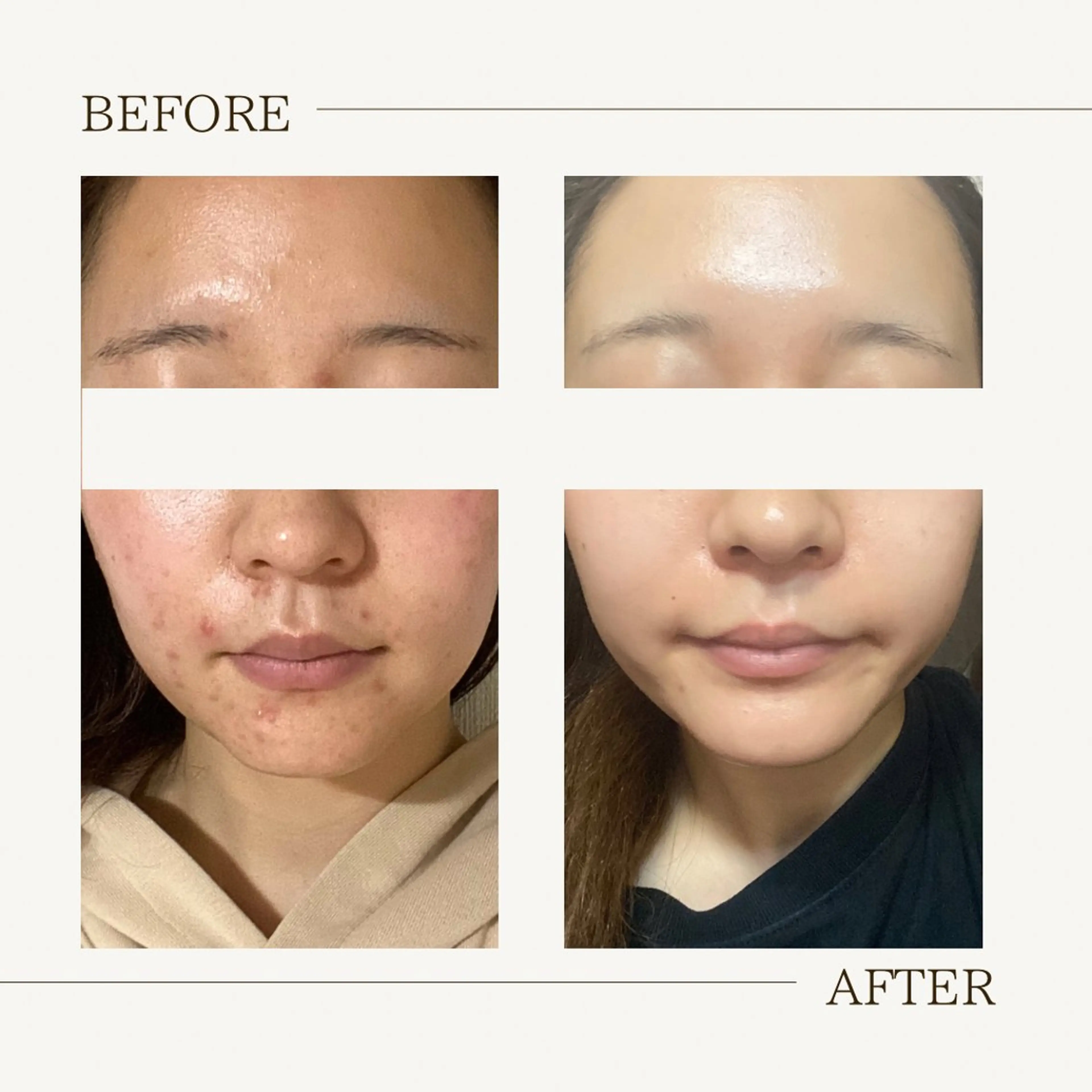 肌育成サロン ♡ RISAのエステ・リラクイメージ