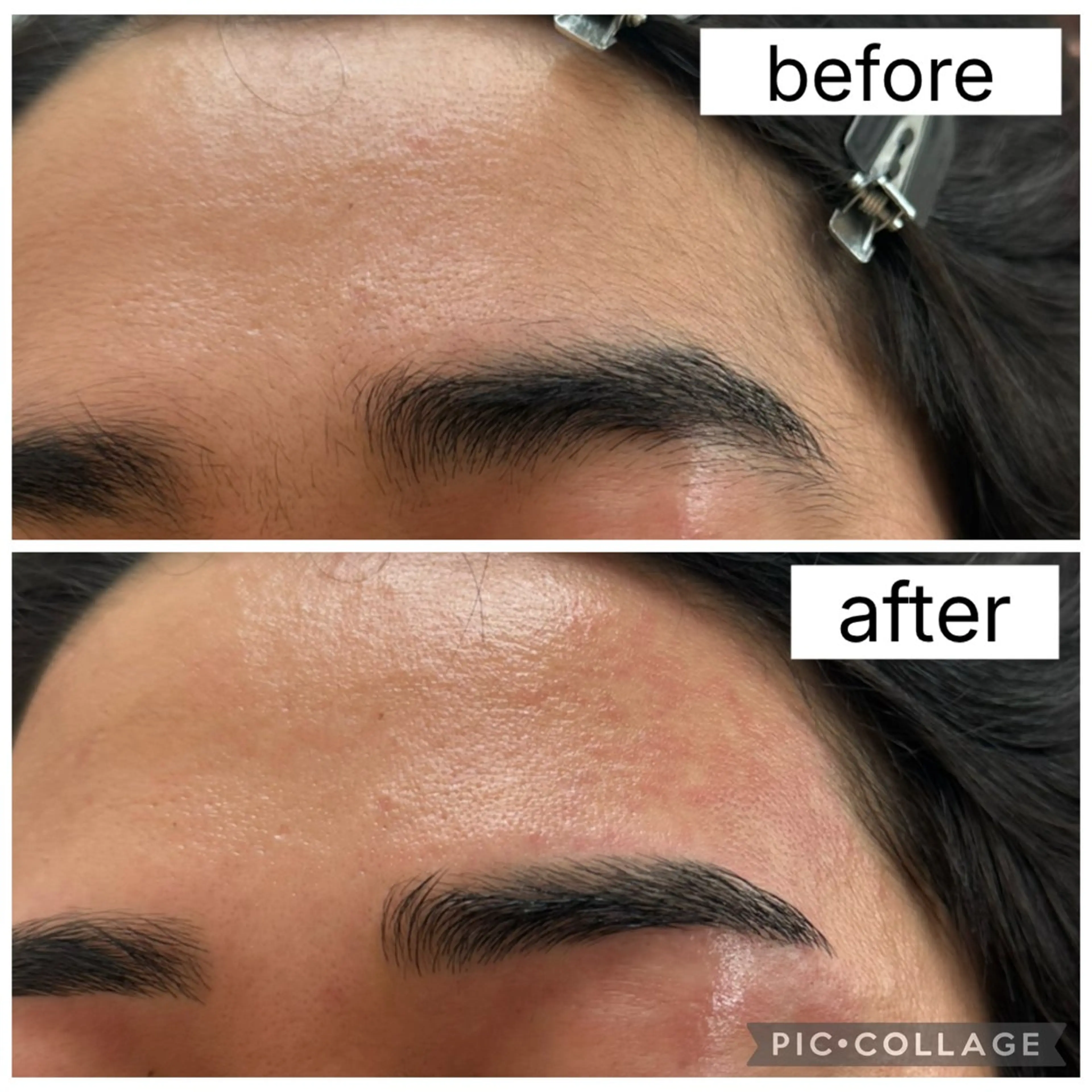 アイブロウ 眉毛ワックス脱毛 ワックス脱毛 その他(アイブロウ) 眉毛/小顔/ハーブ 🌼hikaruの眉毛・アイブロウイメージ