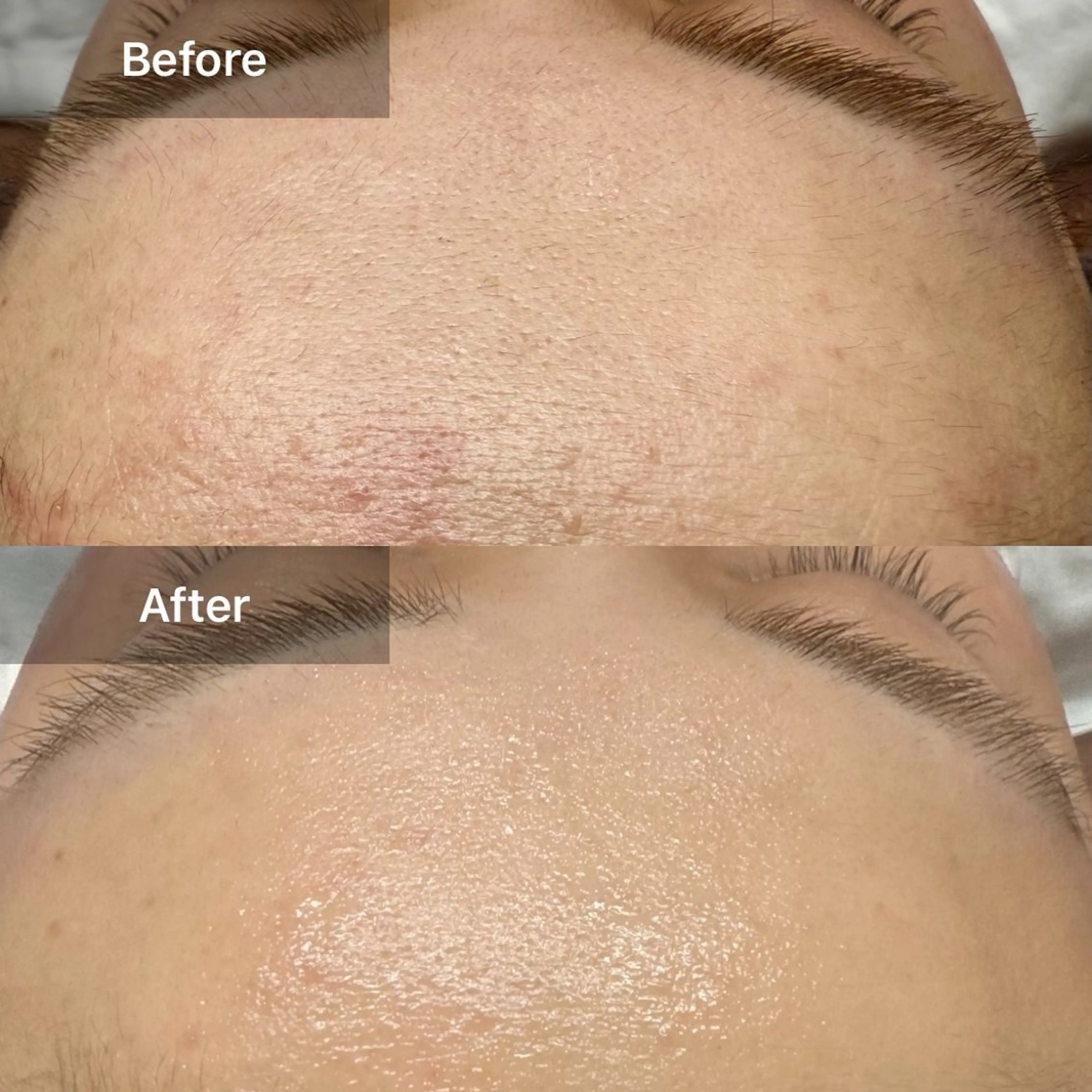 エステ LUNA / Sakikoの眉毛・アイブロウイメージ