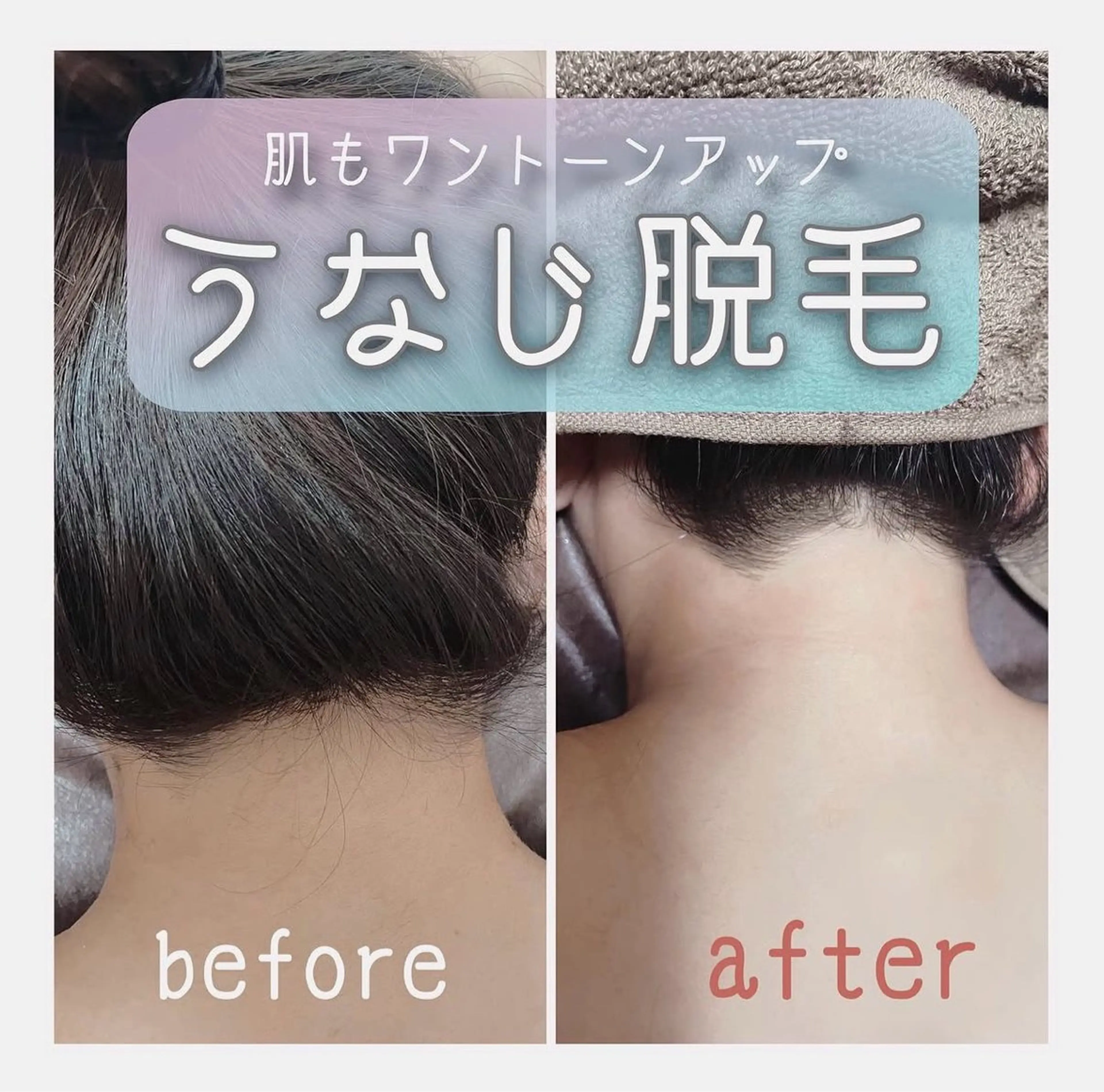 脱毛 鹿島 希璃香のエステ・リラクイメージ