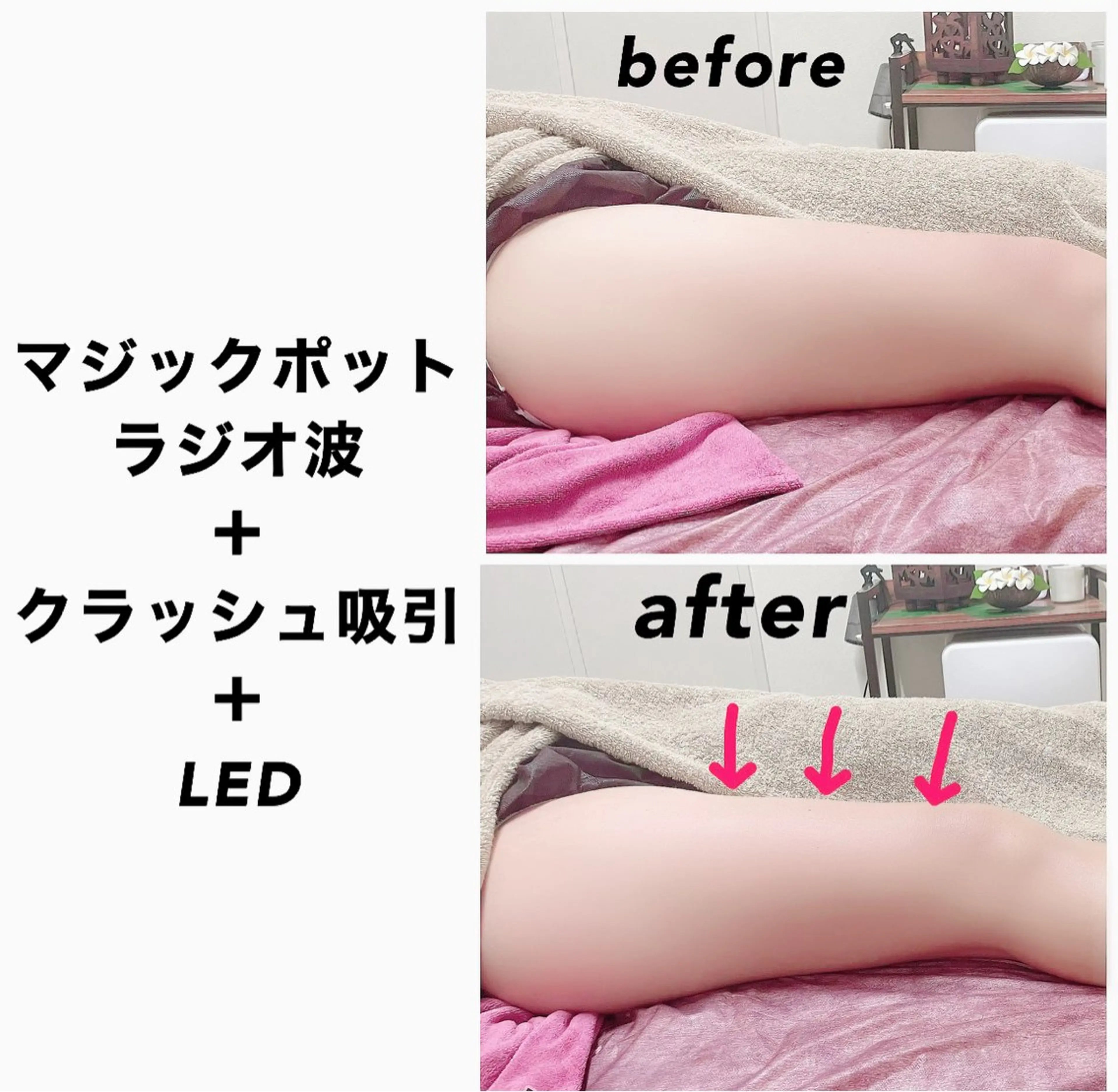 エステ リラク ネイル・エステサロン UILANIのネイルデザイン