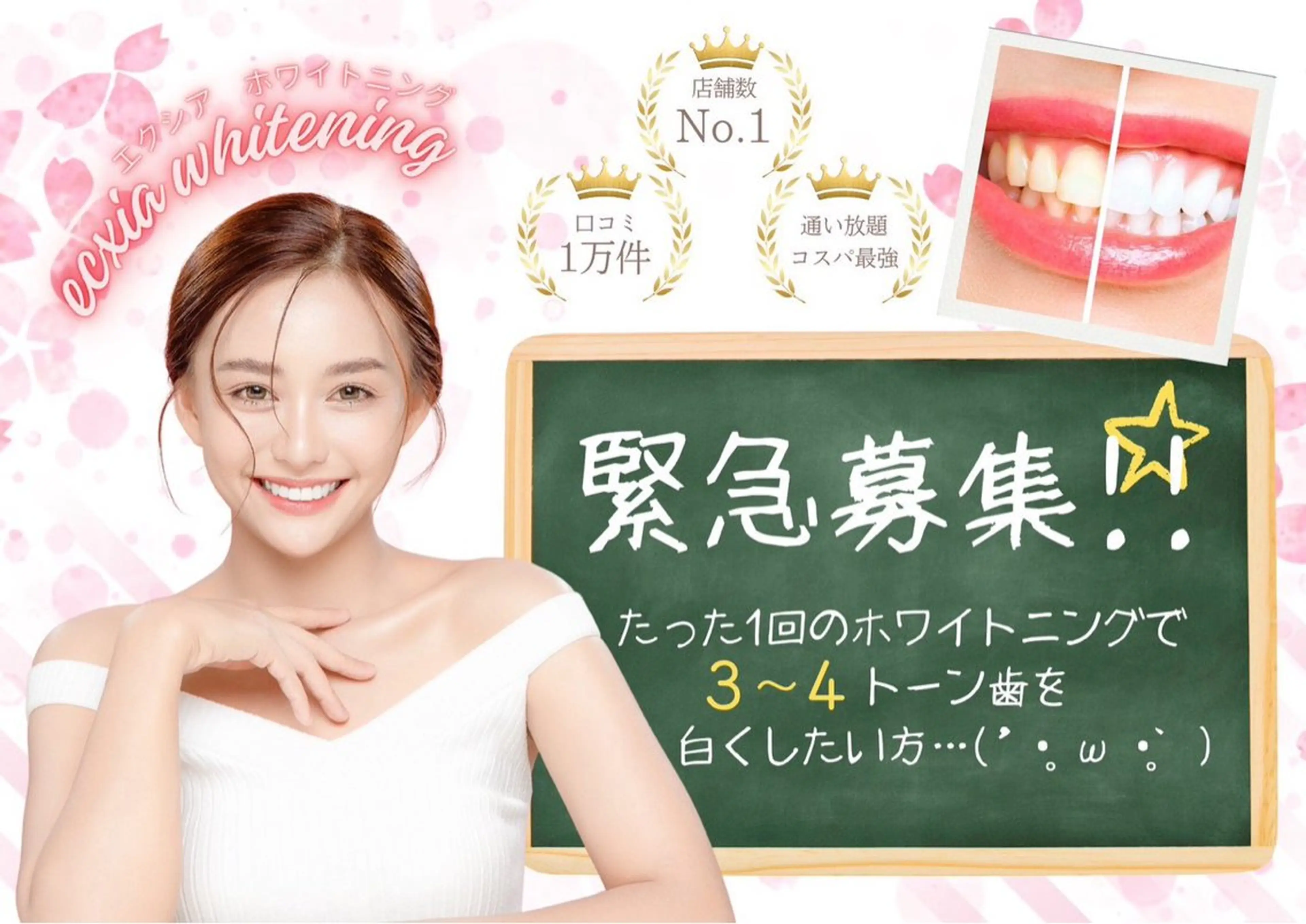 オープン１周年CP♪【4/12.13.14来店限定】継続率90％ ¥5,000→の写真