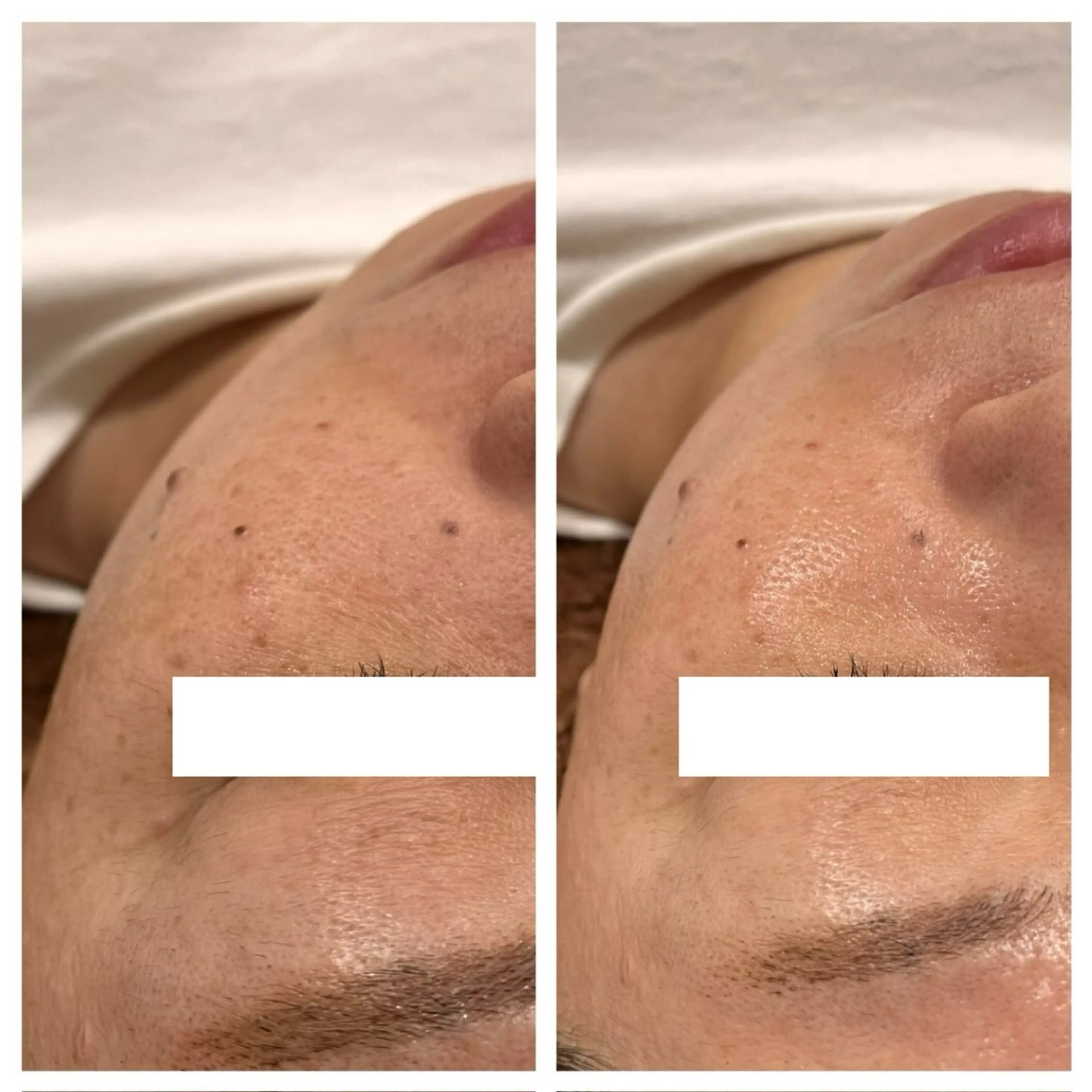 エステ tejina suuのエステ・リラクイメージ