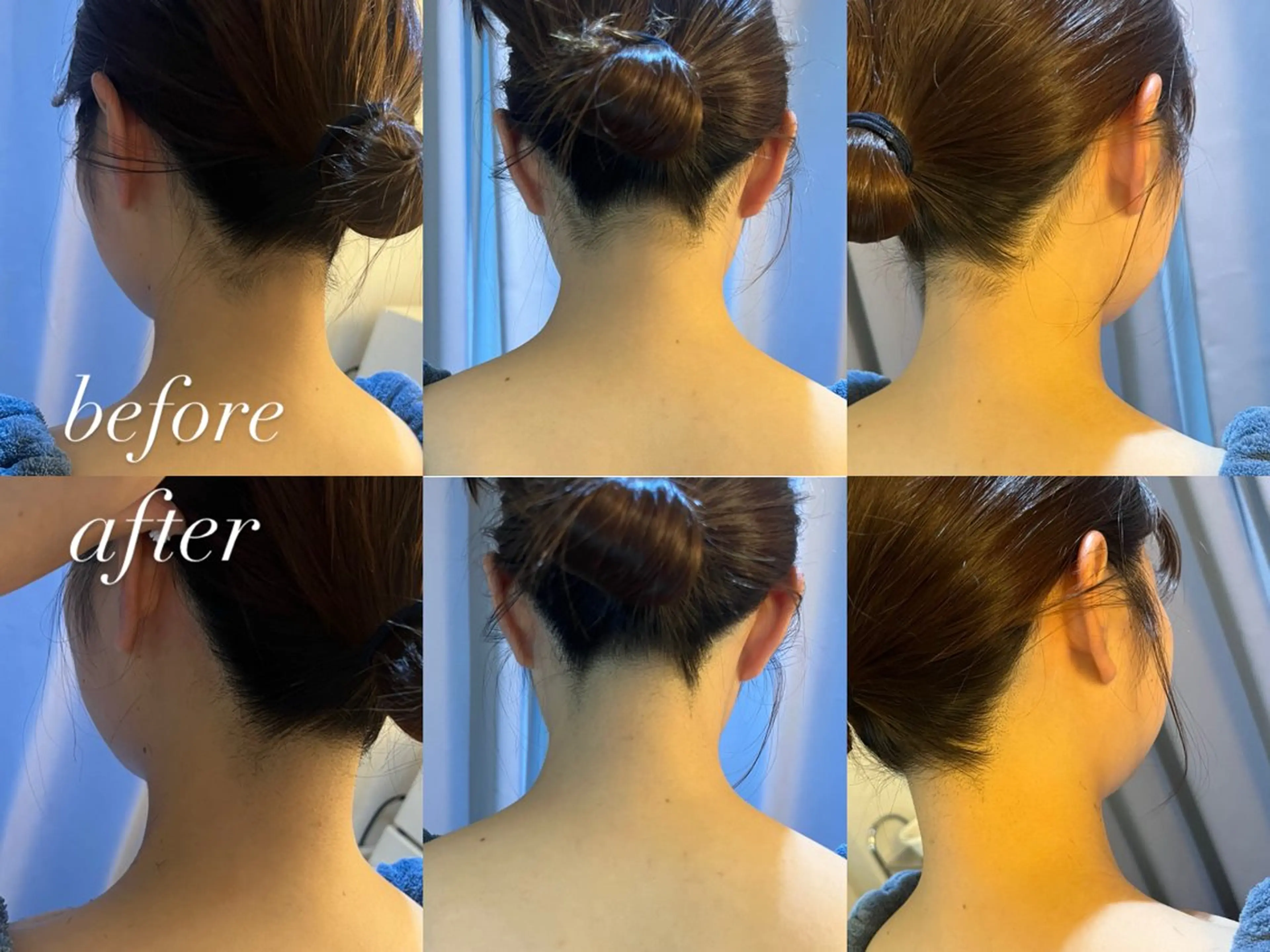 うなじ脱毛/美肌脱毛 LABELのエステ・リラクイメージ