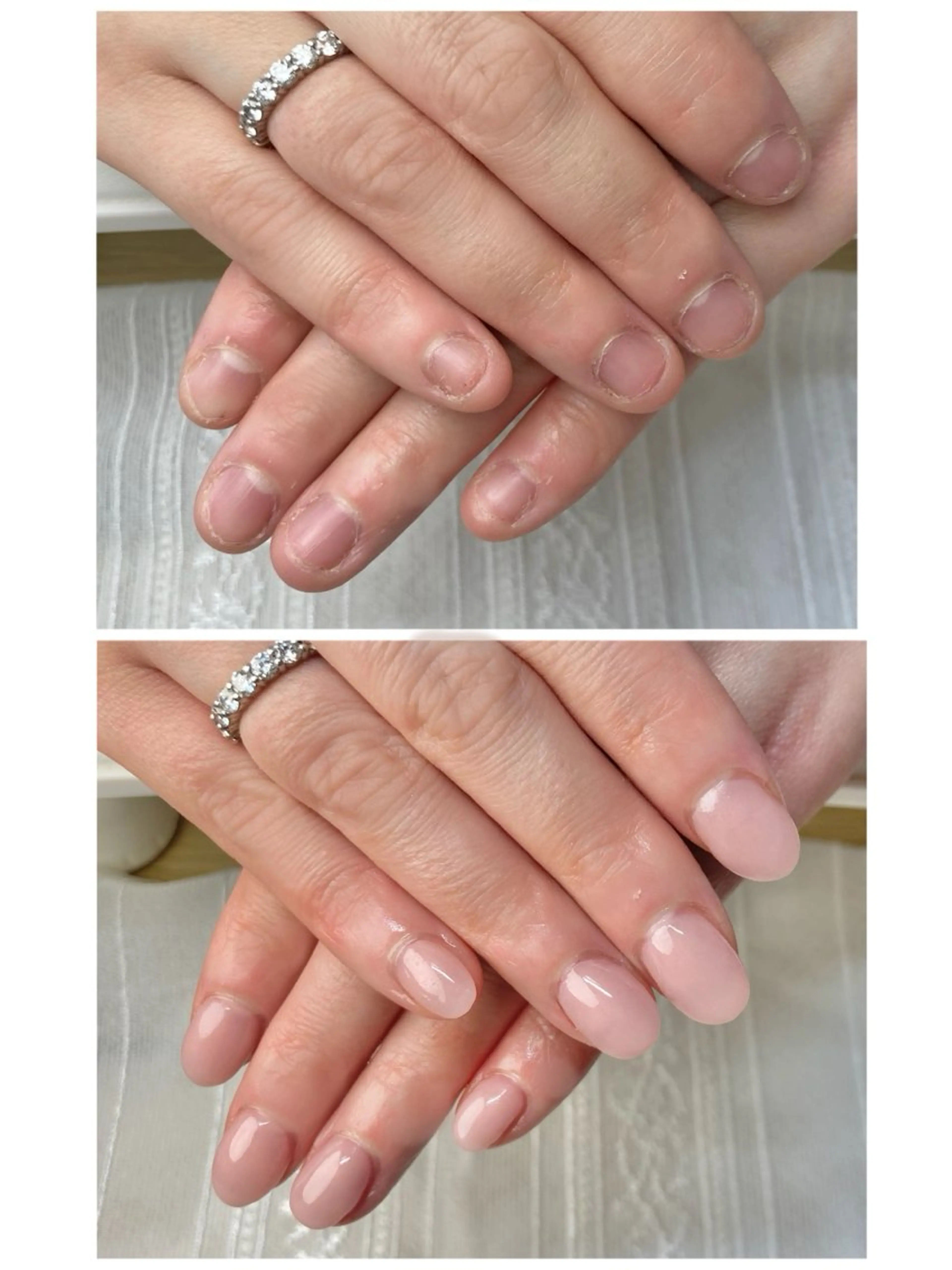 【４月限定価格】【深爪の方のみご予約可】深爪矯正×長さだしで、即日で深爪を綺麗に（ワンカラー）の写真