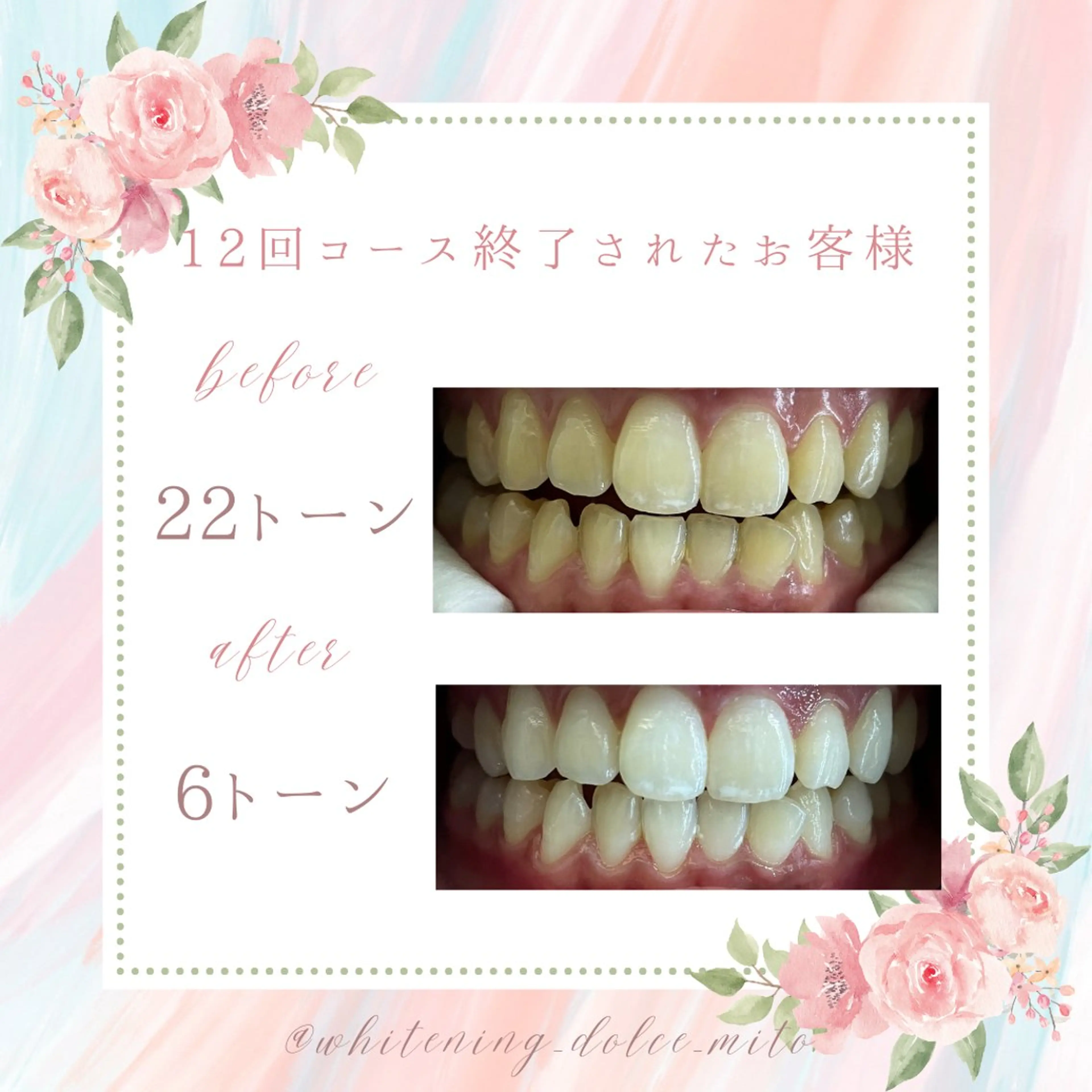 セルフホワイトニング Dolce八王子店のその他イメージ