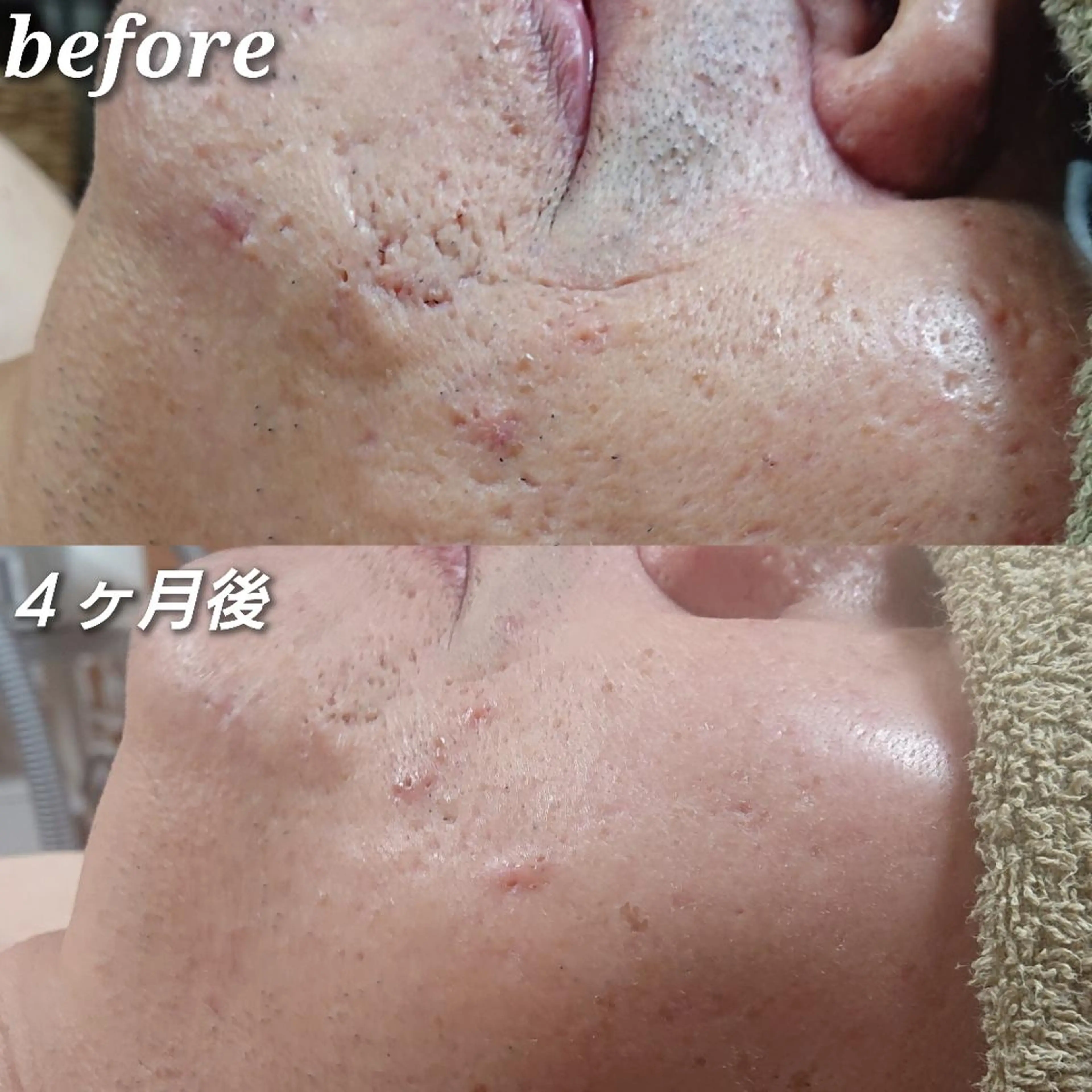 Rum Hinna ラムヒンナーのその他イメージ