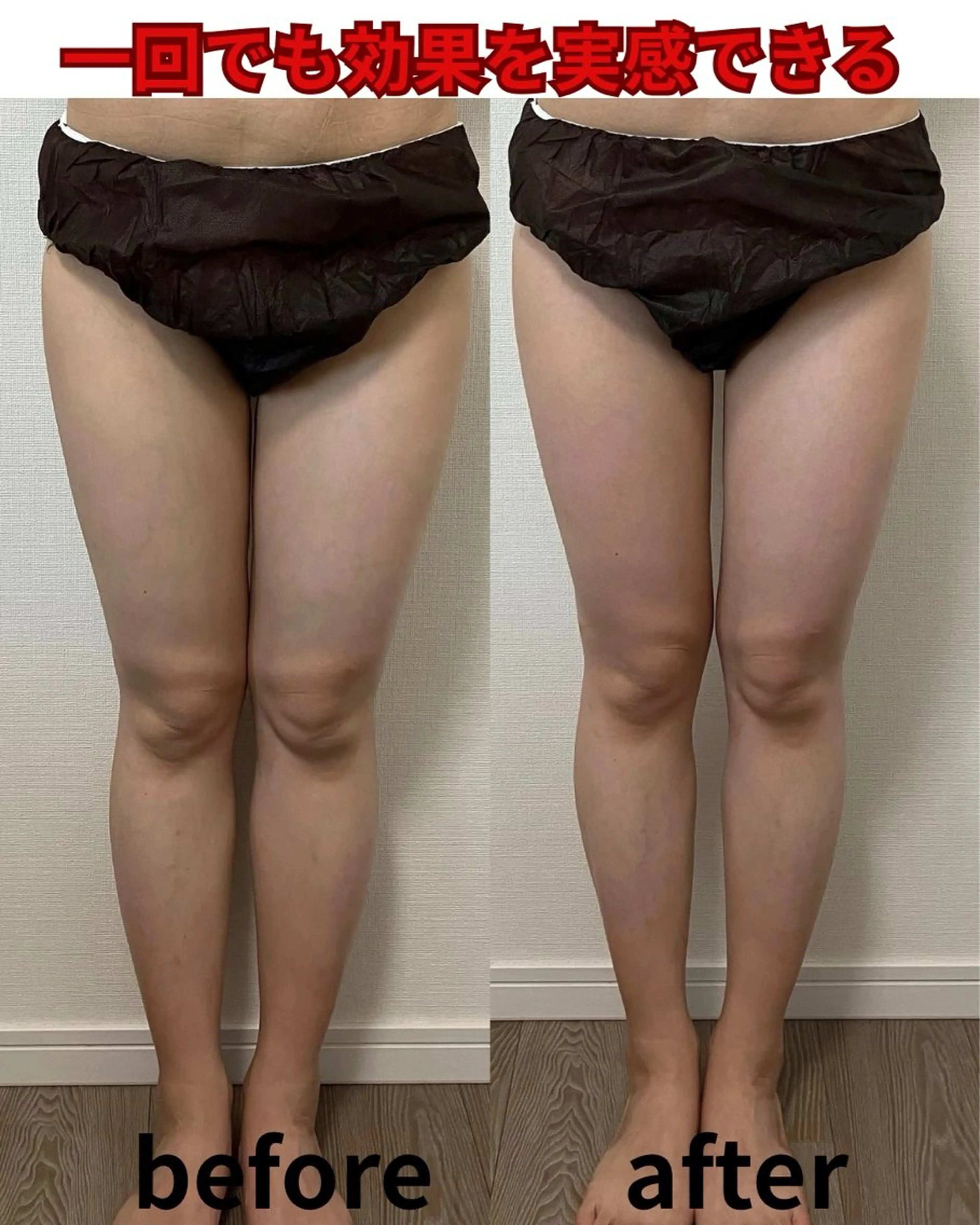 3月限定！細見えスッキリ美脚90分コース🦵¥17,800→¥7,980の写真