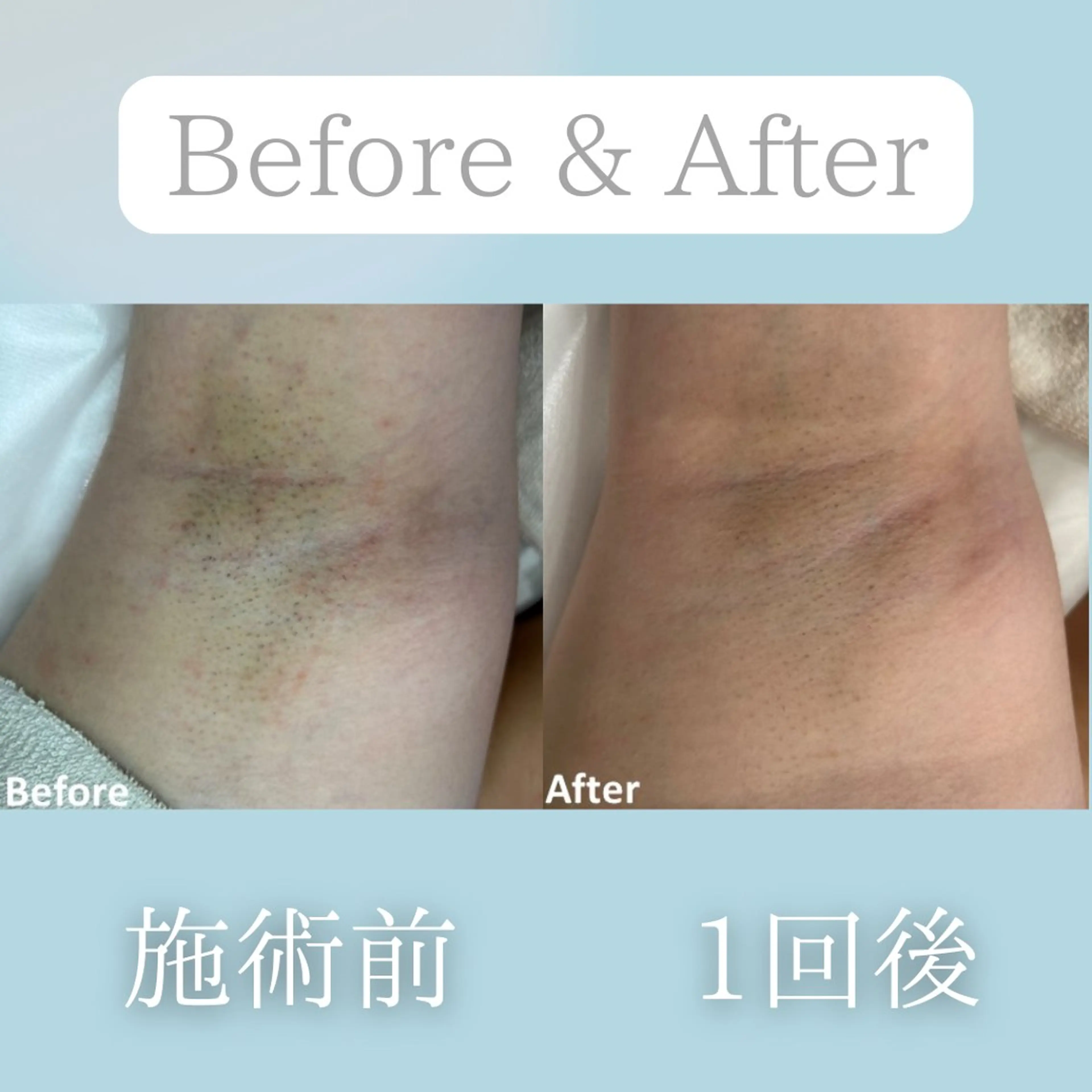 美肌脱毛&毛穴専門 Nico🐰ྀི♡のエステ・リラクイメージ