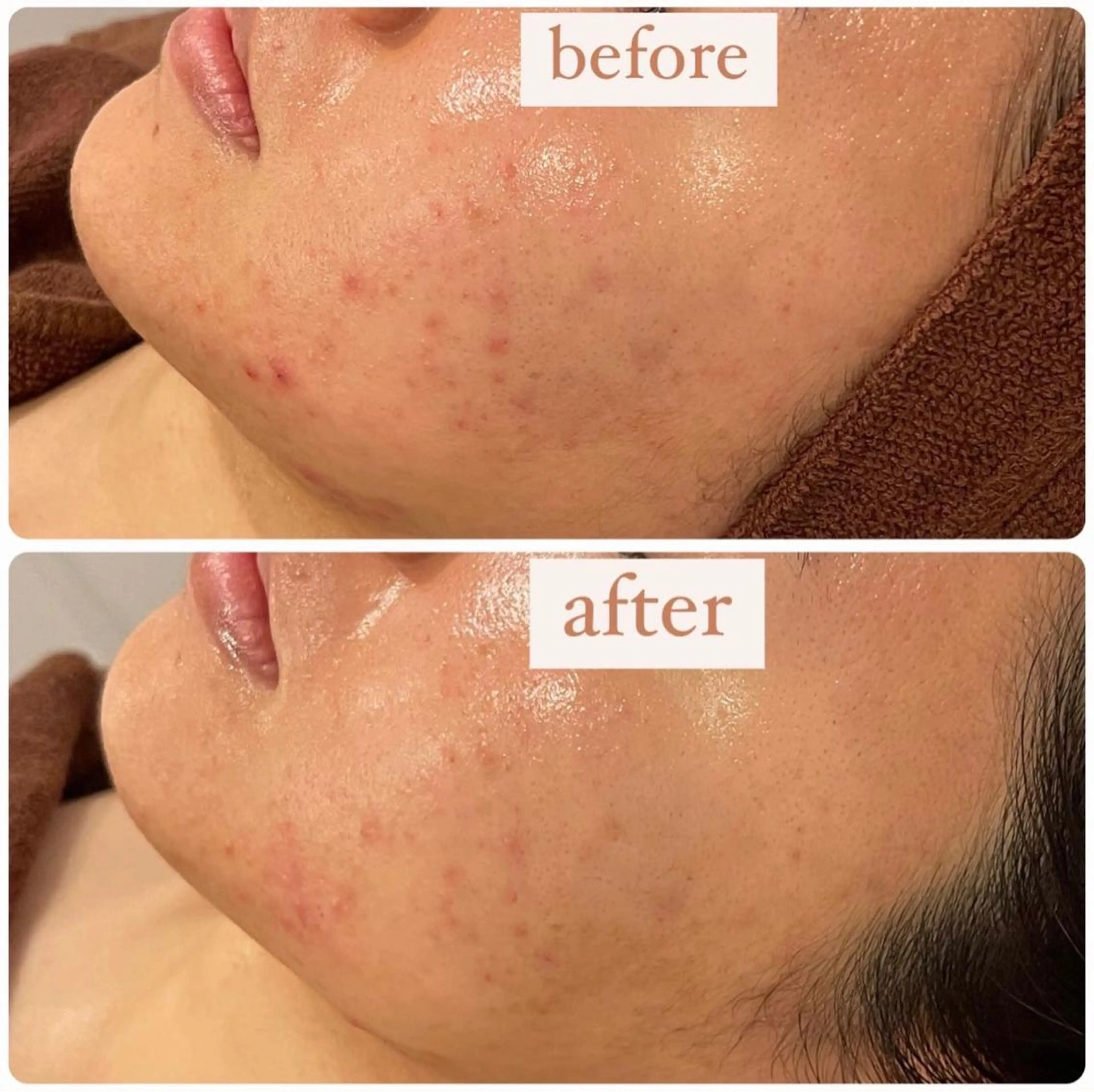 立体小顔×艶肌×美ボ ディ似合わせ施術 岡のエステ・リラクイメージ