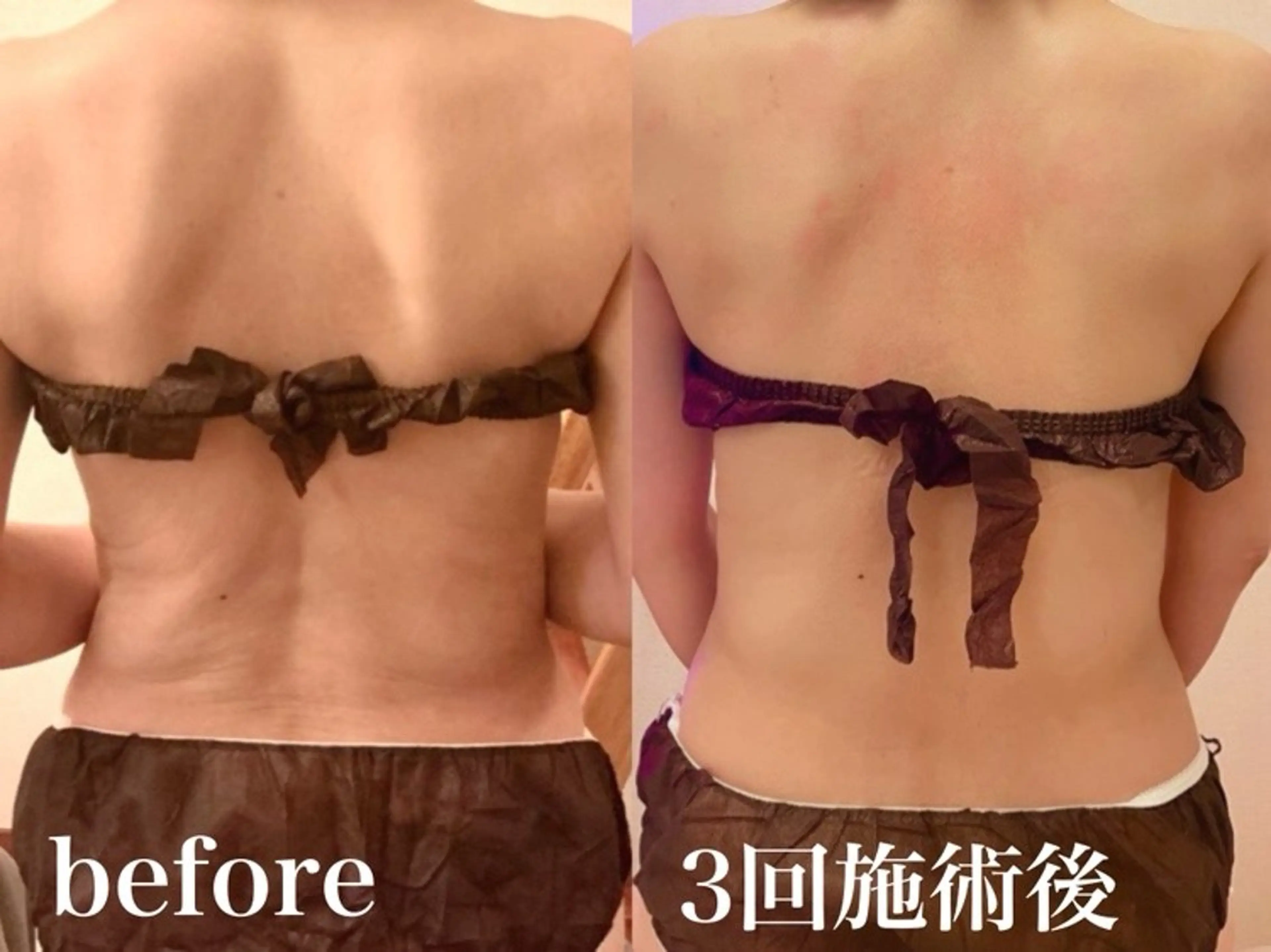 エステ リラク エステサロンMOA (モア)のエステ・リラクイメージ