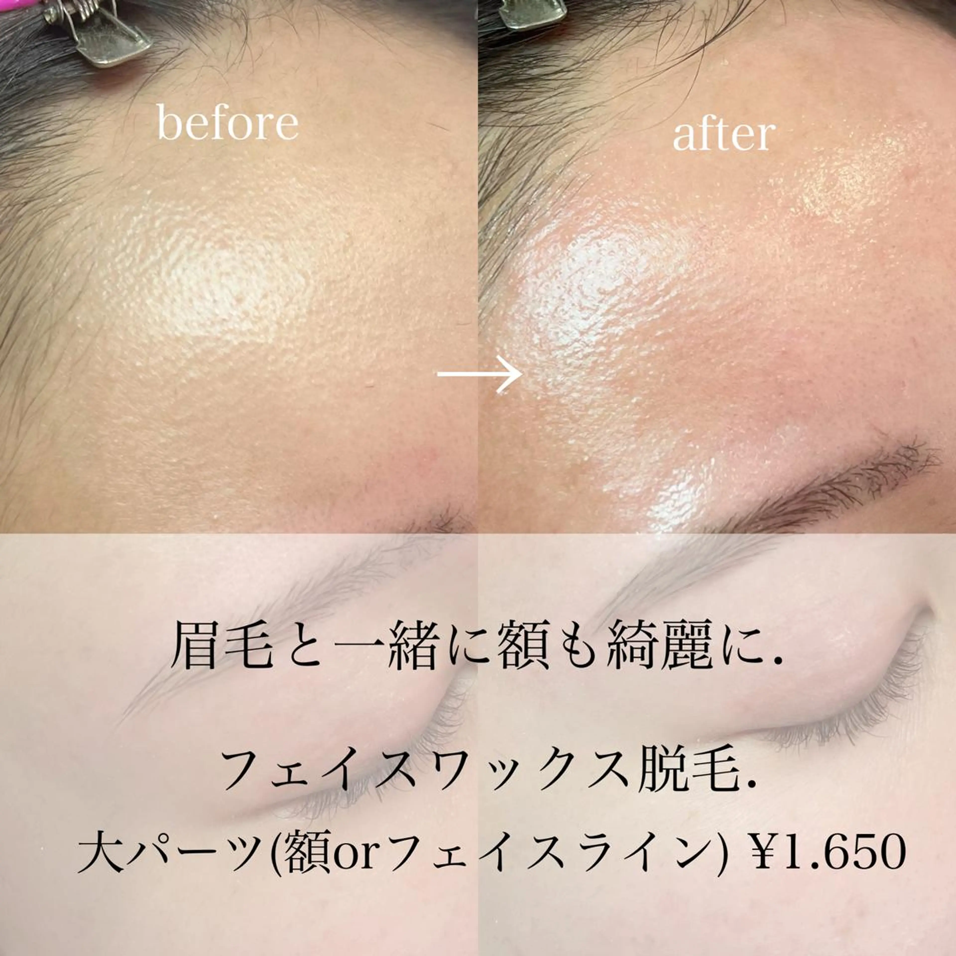 アイブロウ Lea堺東　毛穴洗浄 ×顔ワックス脱毛のその他イメージ