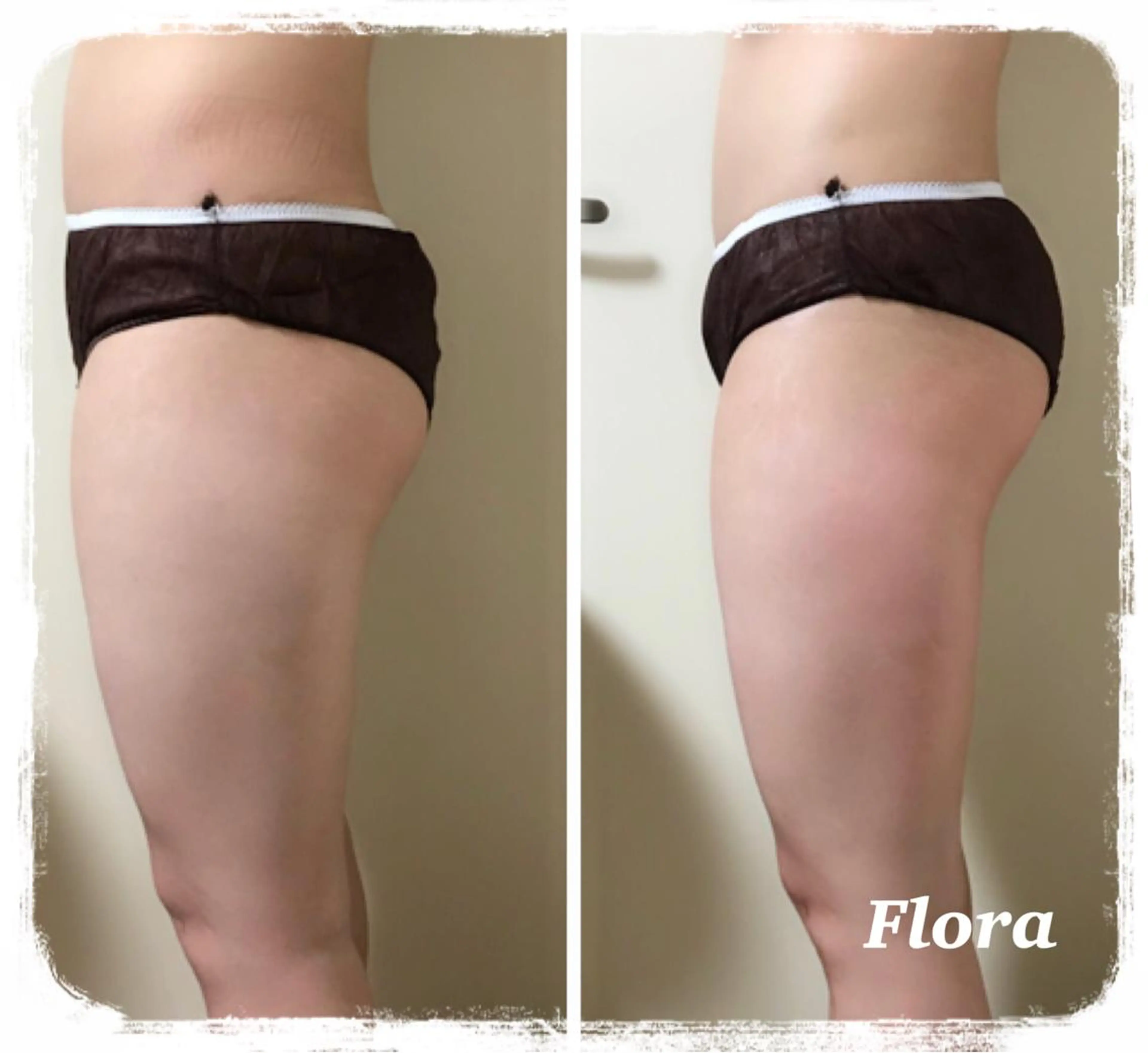 温活痩身エステ Floraのエステ・リラクイメージ